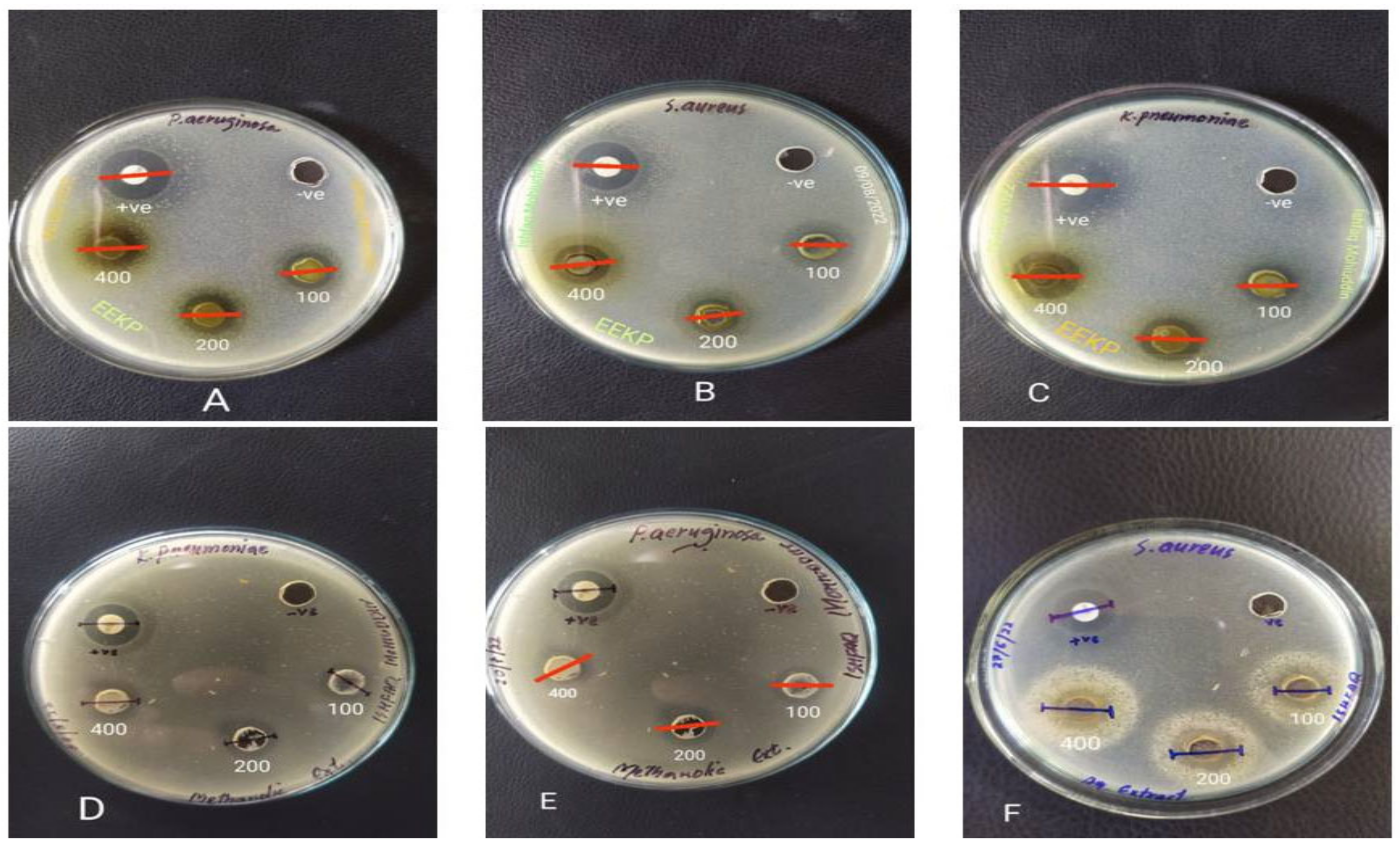 Separations 09 00363 g003