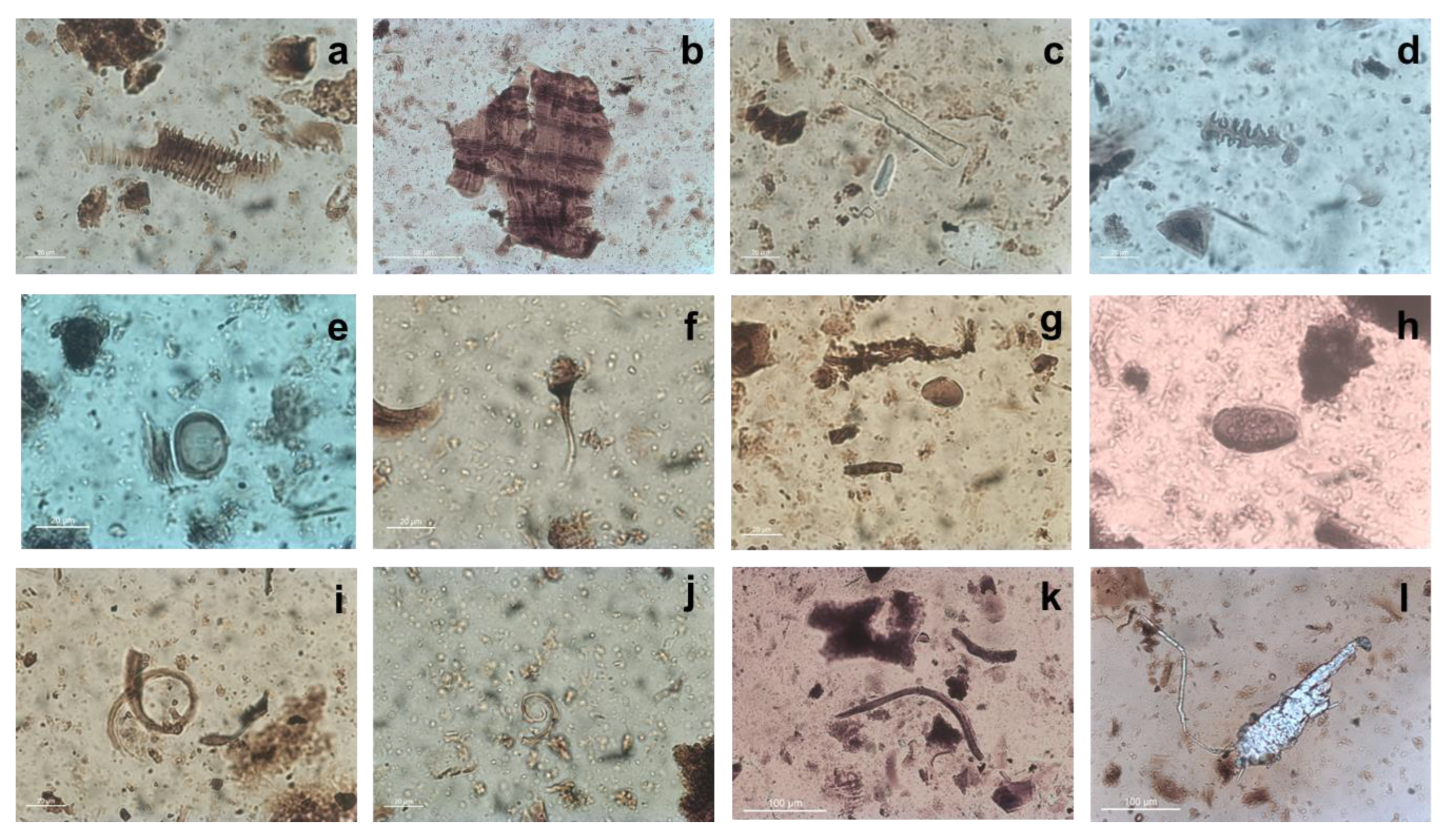 Separations 10 00085 g006 Separations 10 00085 g006