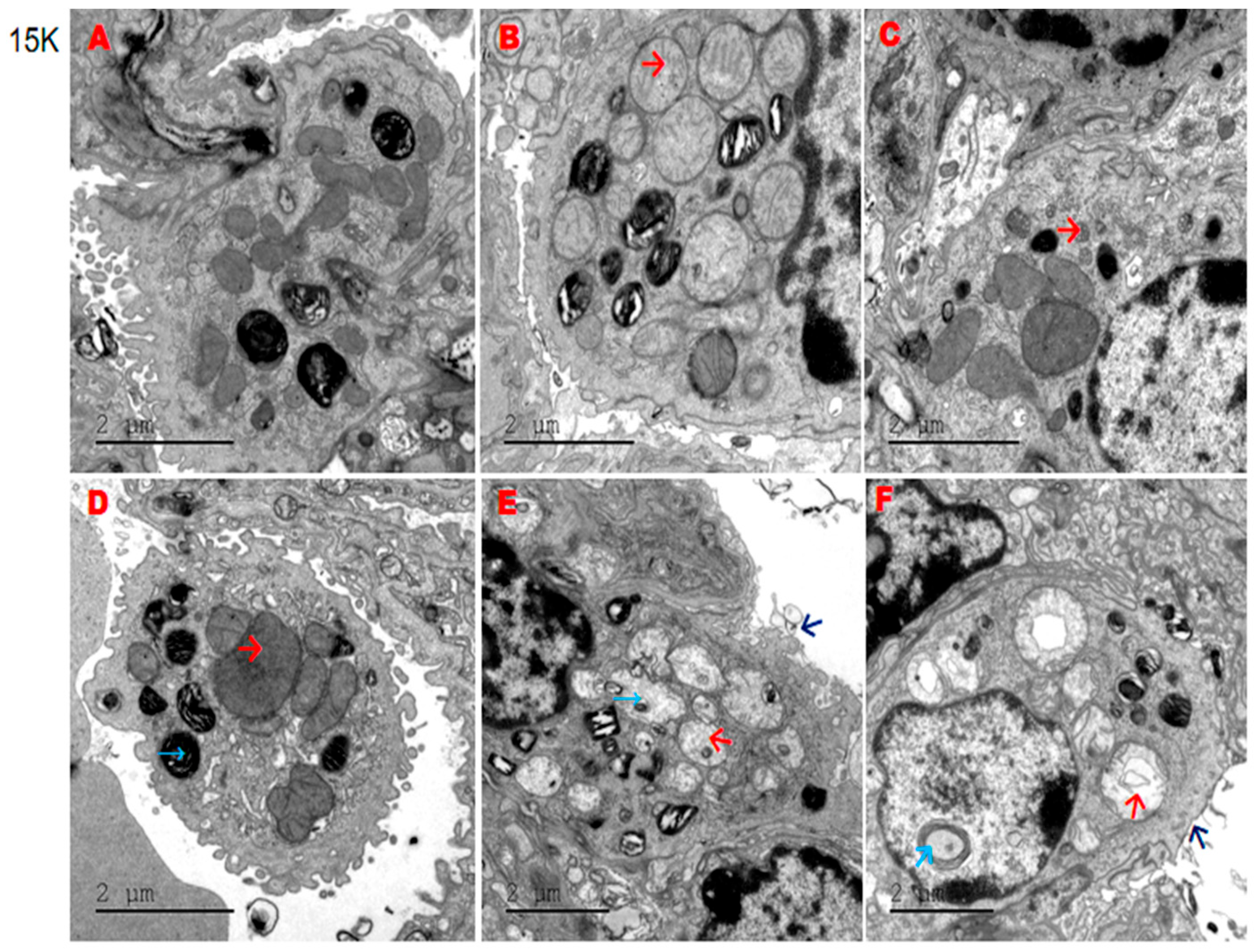 Separations 11 00074 g003
