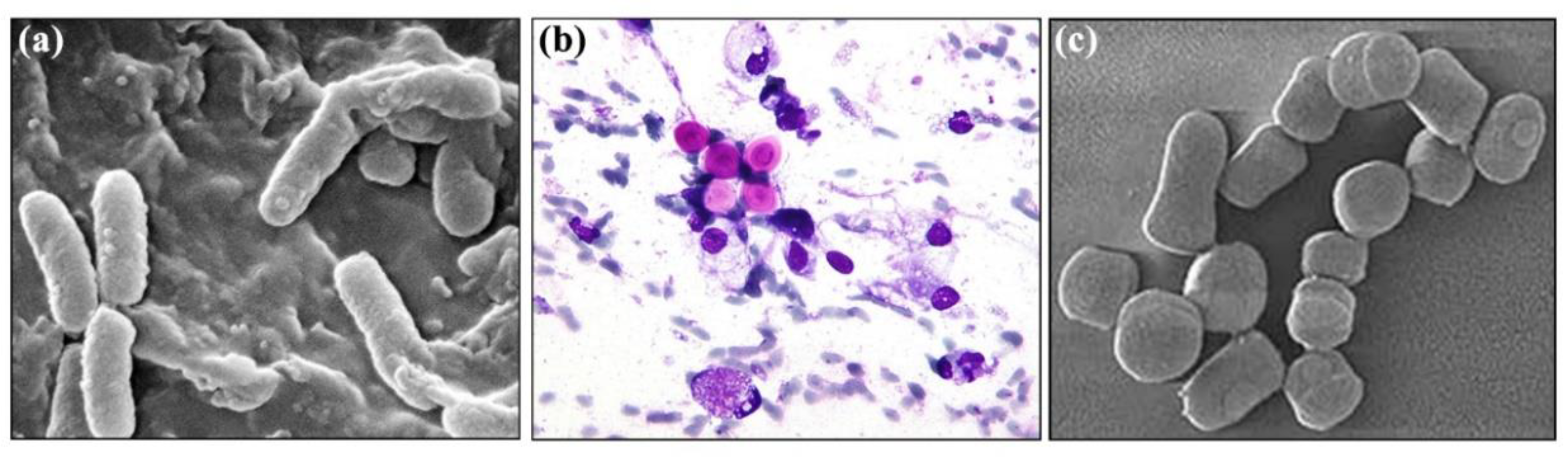 Separations 11 00299 g009