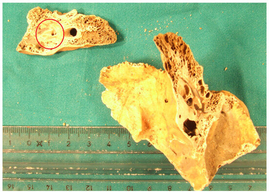 Separations 12 00263 g0a2