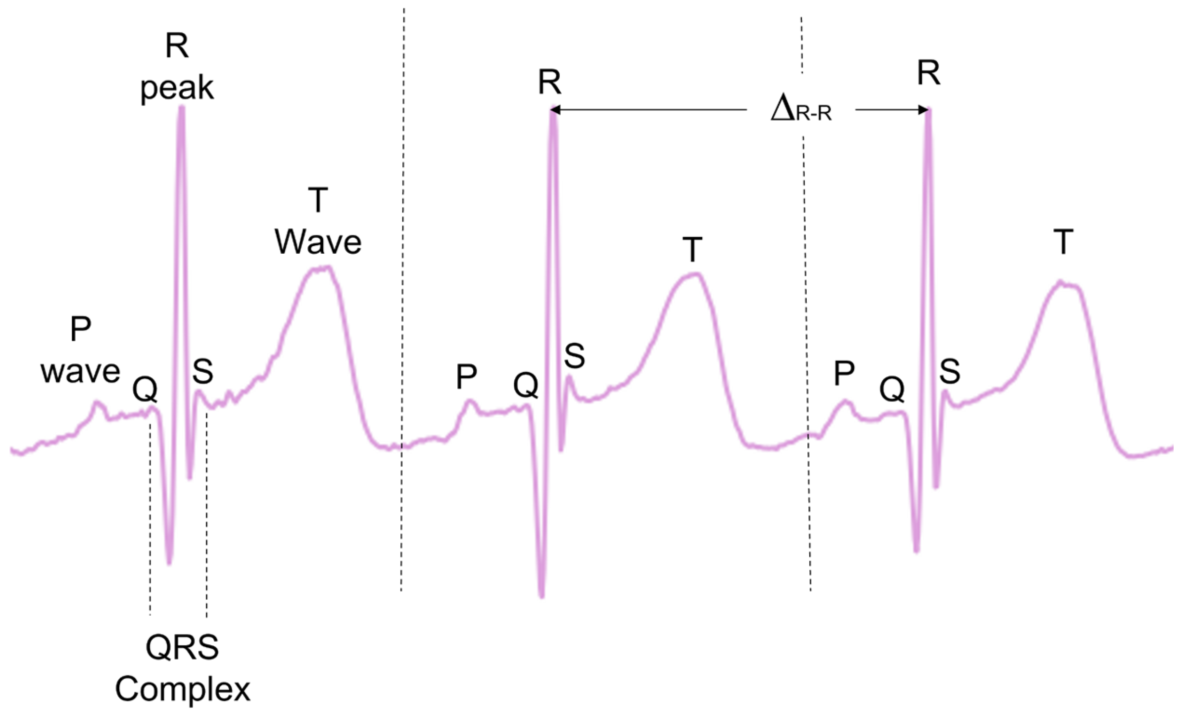 Signals 05 00007 g001