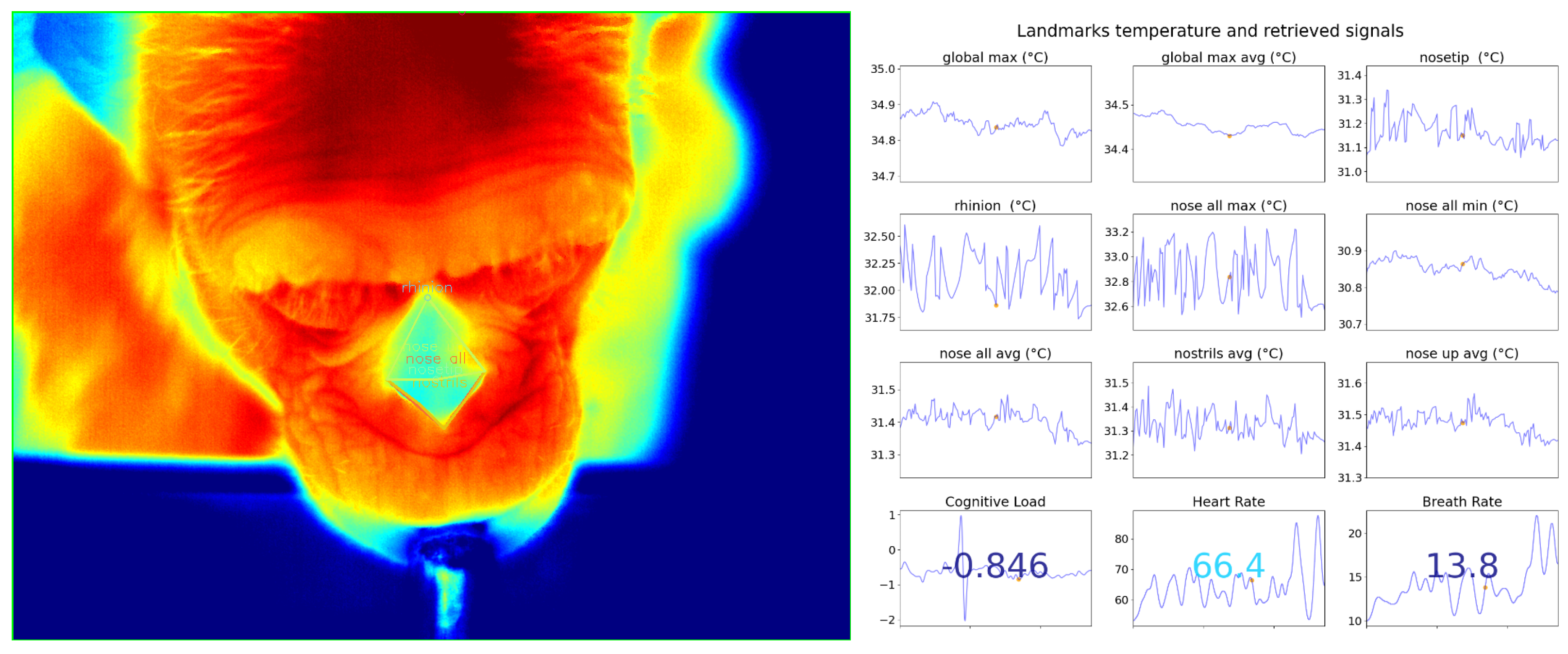 Signals 05 00008 g008