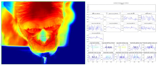 Signals 05 00008 g0a6
