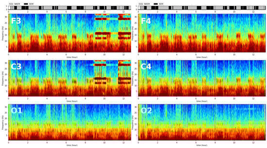 Signals 05 00038 g0a2