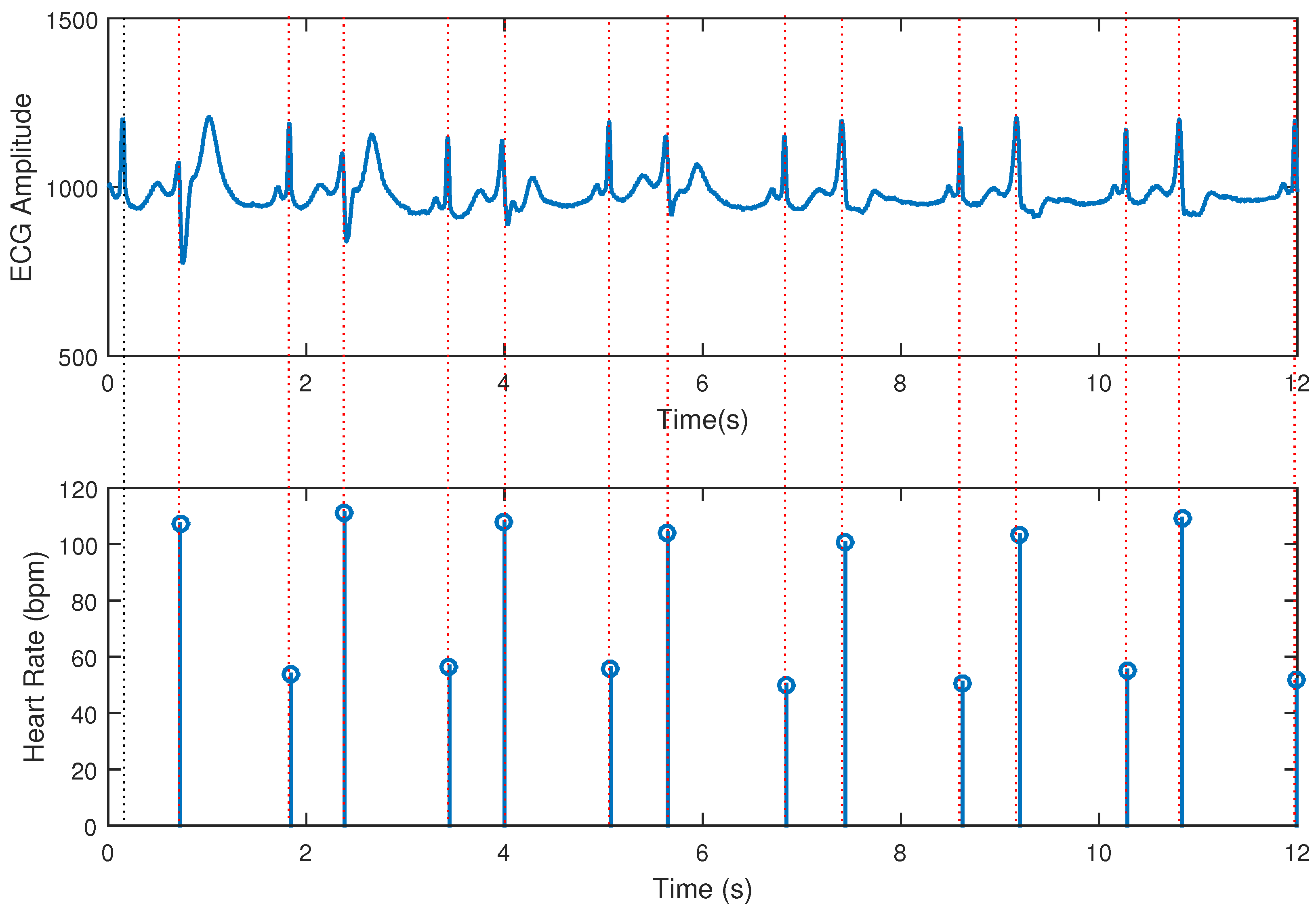 Signals 06 00015 g011 Signals 06 00015 g011