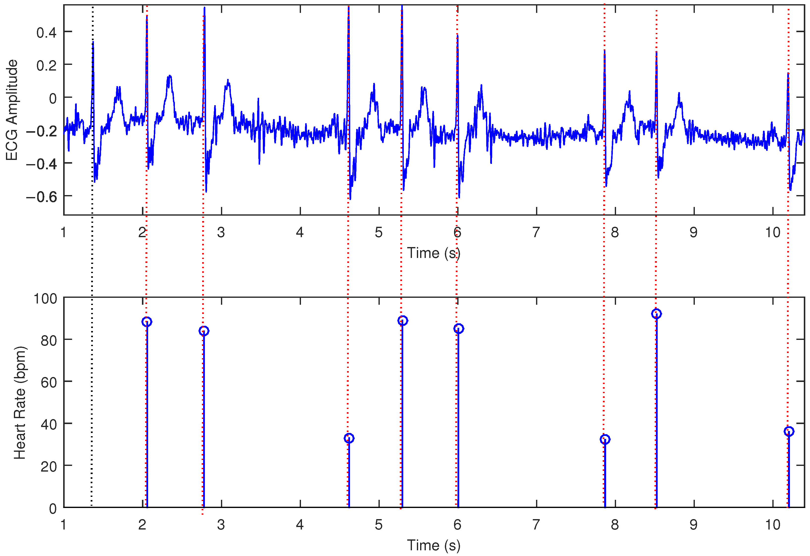 Signals 06 00015 g012 Signals 06 00015 g012