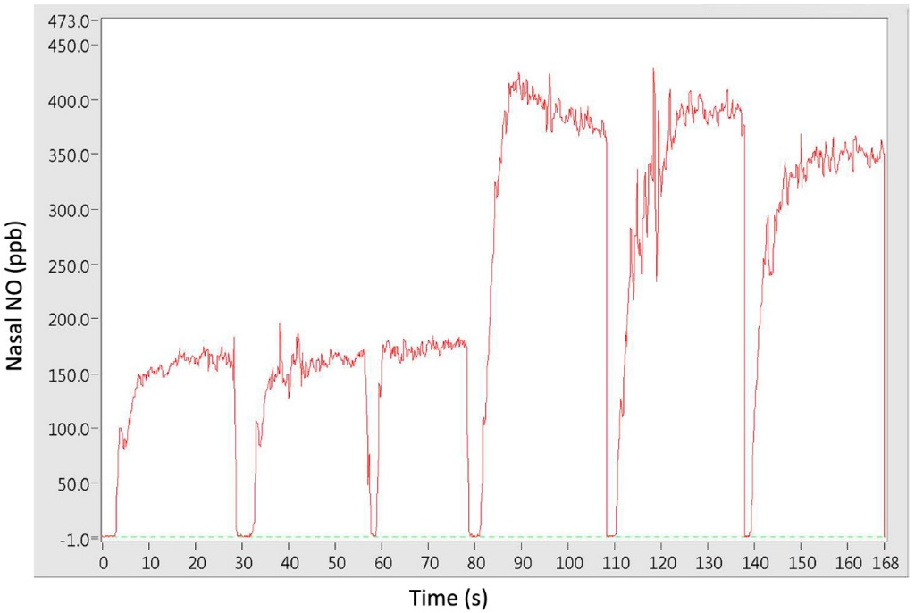 Sinusitis 01 00013 g002 1024