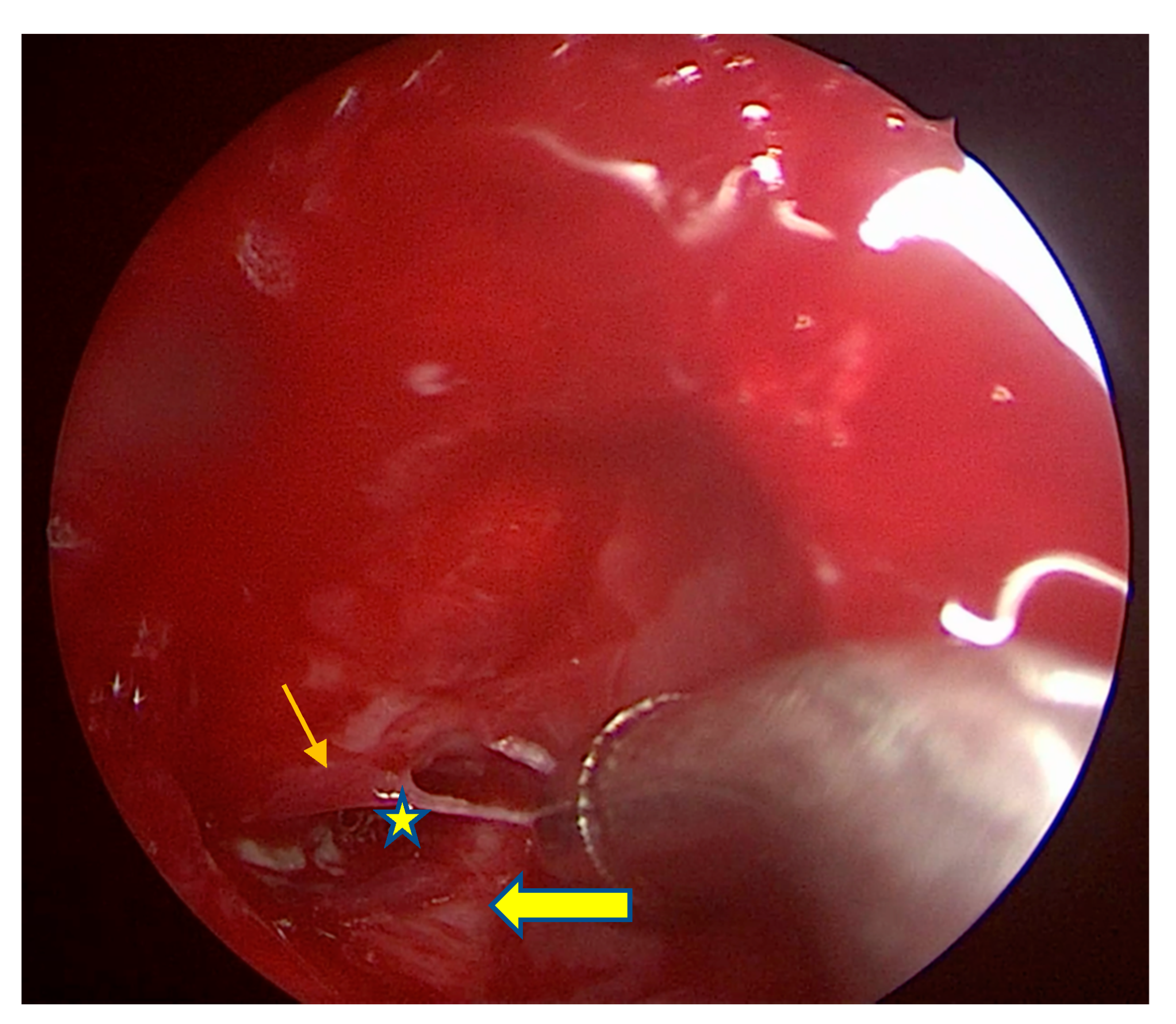 Sinusitis 05 00008 g002