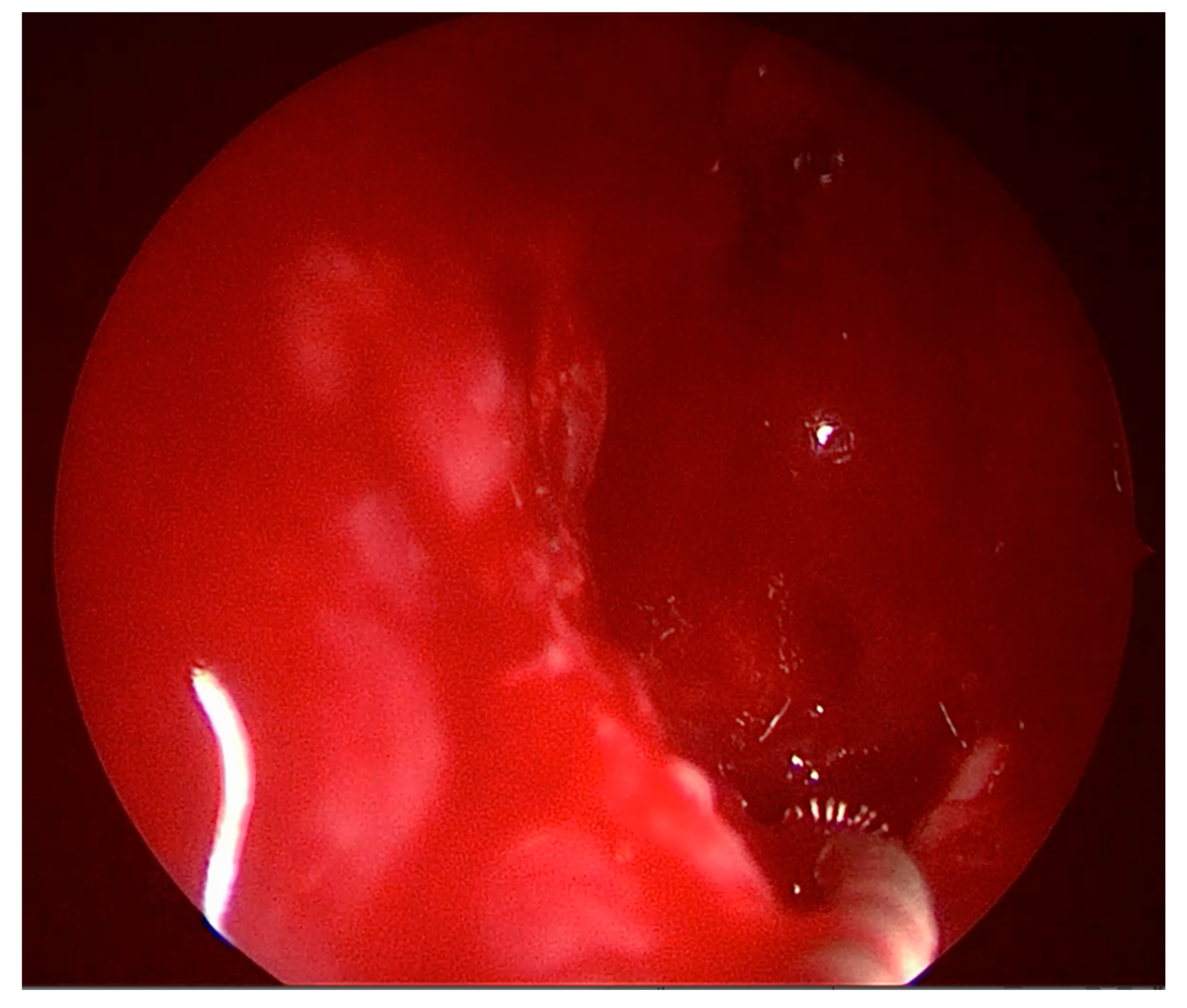 Sinusitis 05 00008 g004