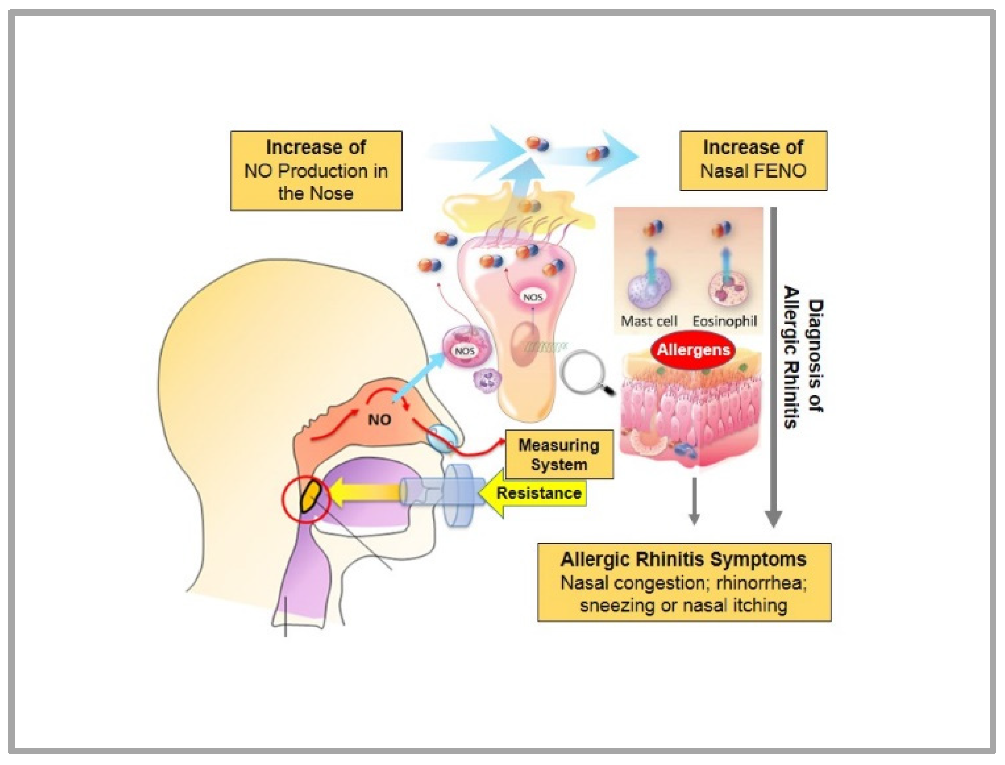 Sinusitis 05 00013 g003