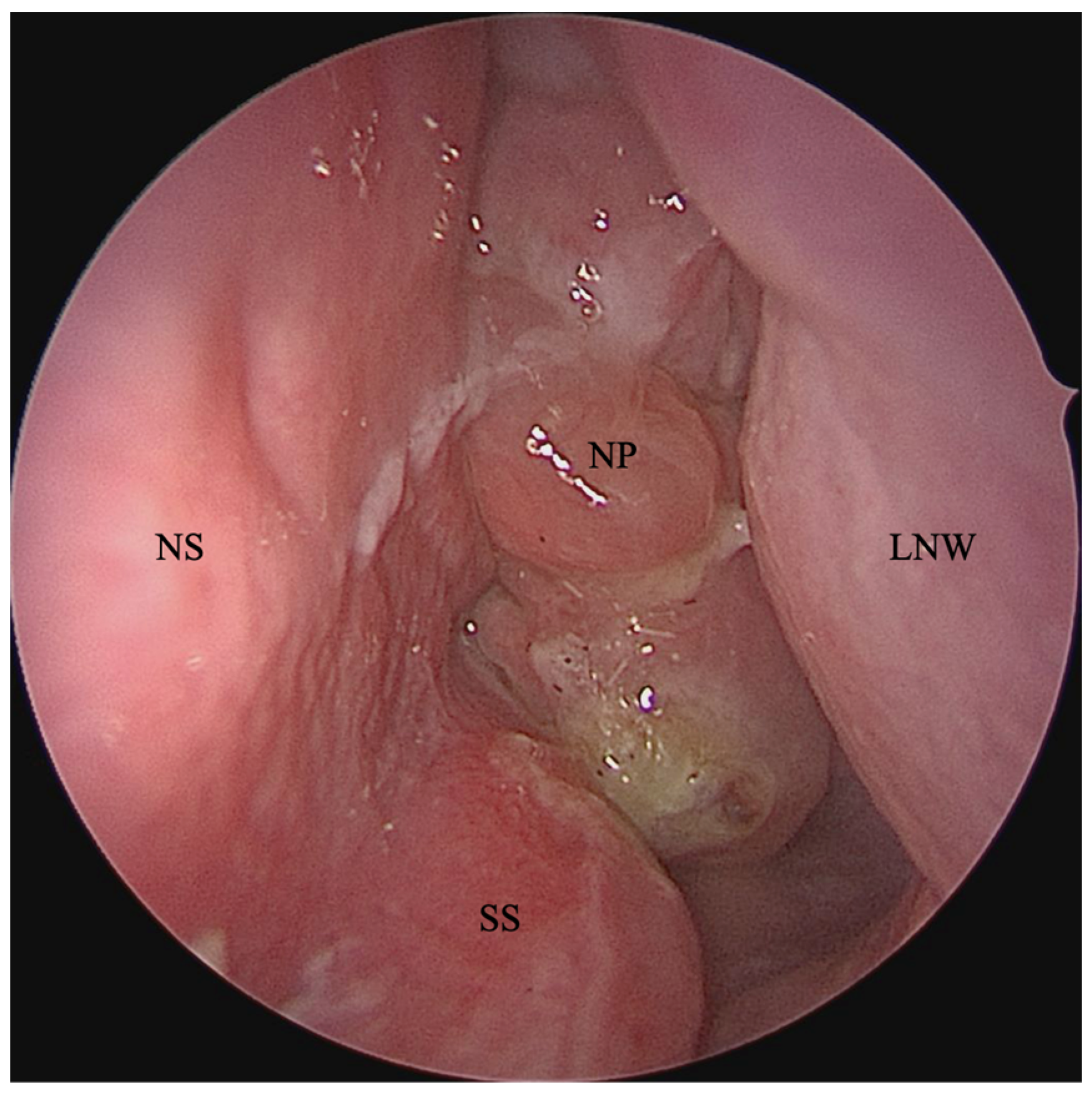 Sinusitis 07 00004 g001