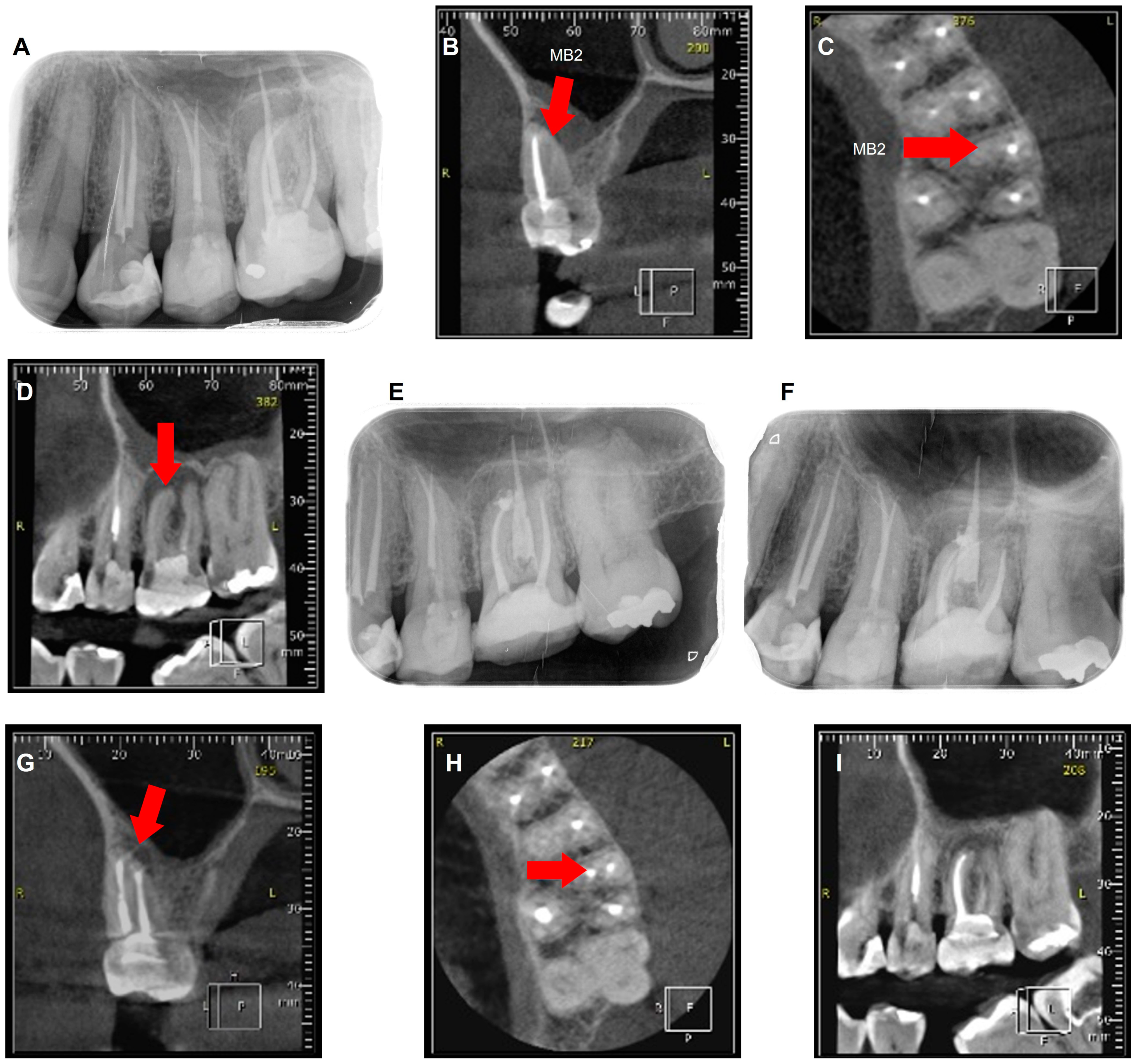 Sinusitis 09 00001 g001