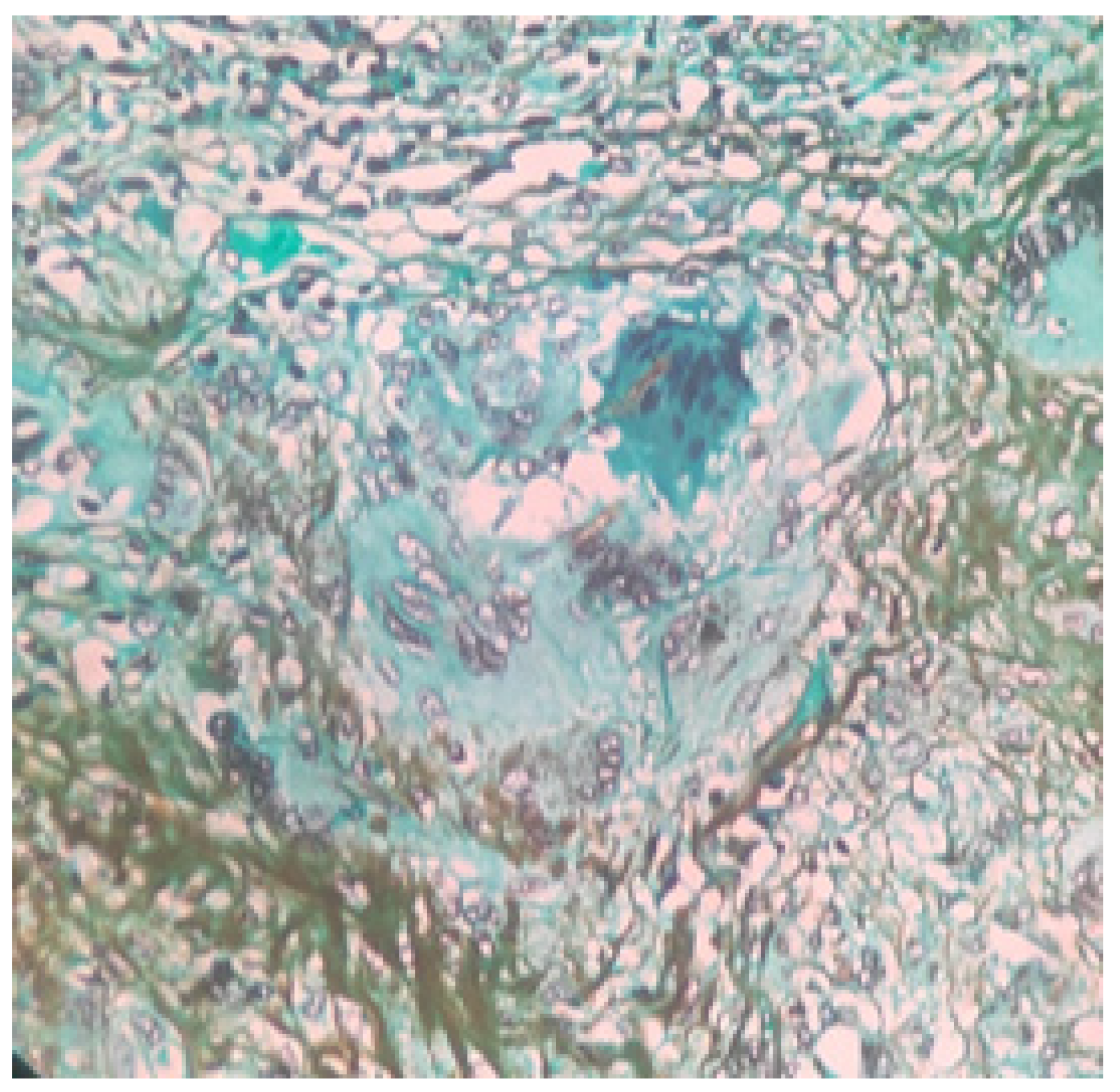 Sinusitis 09 00004 g004