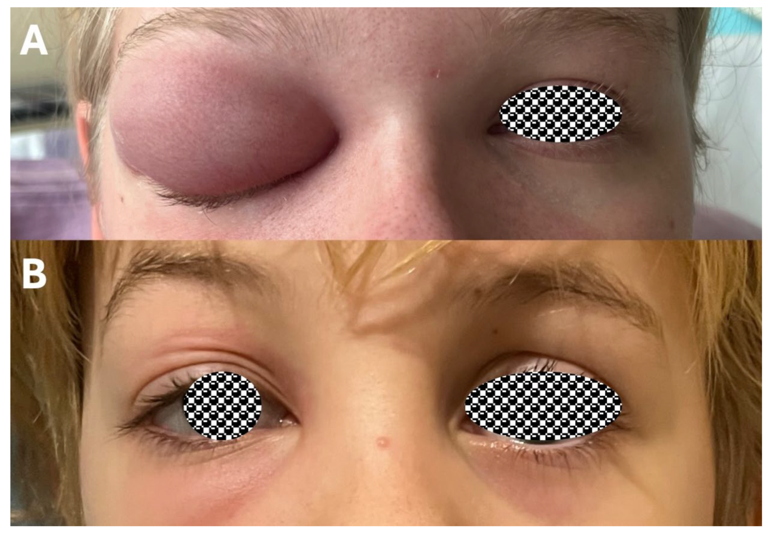 Sinusitis 09 00011 g005 Sinusitis 09 00011 g005