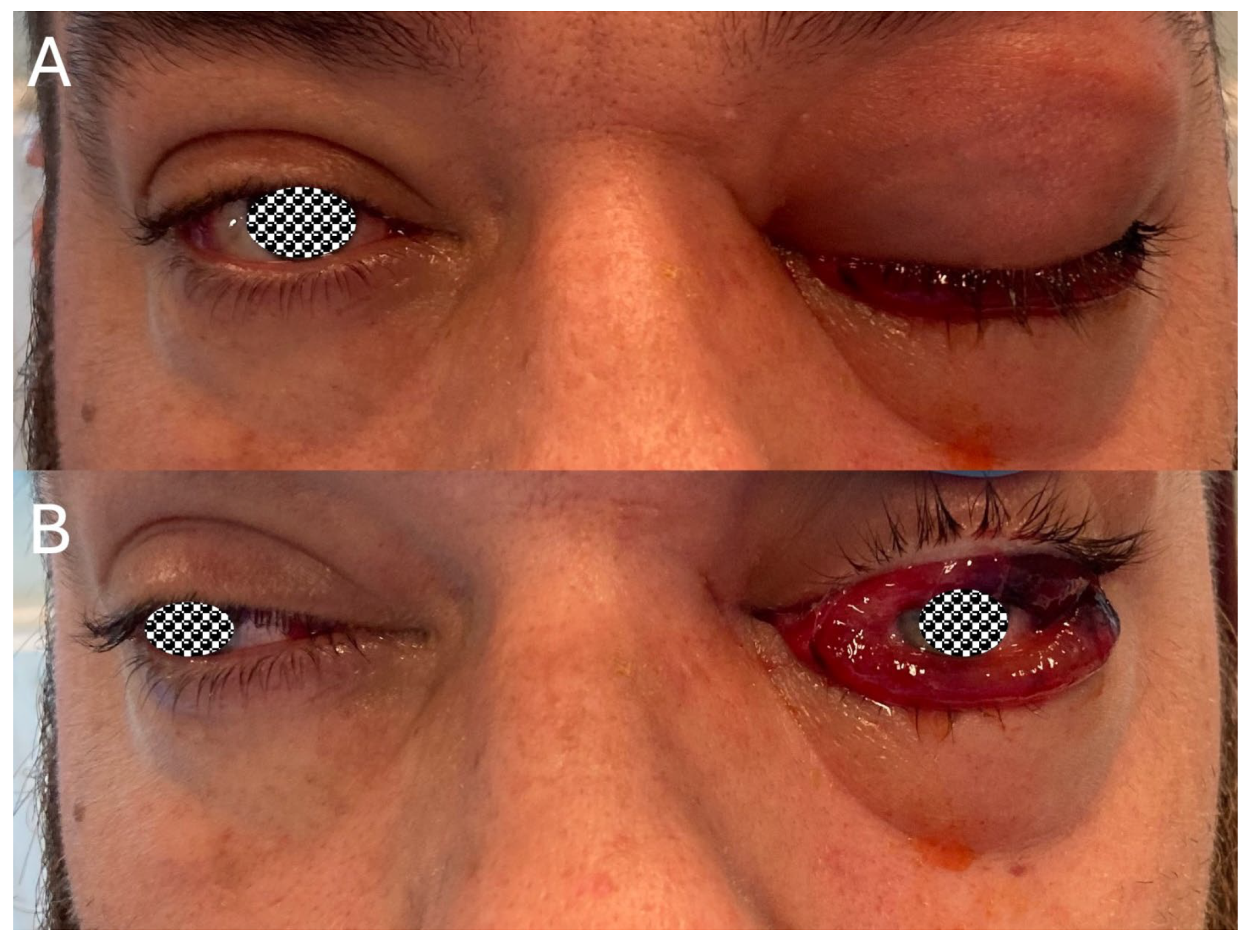 Sinusitis 09 00011 g006 Sinusitis 09 00011 g006