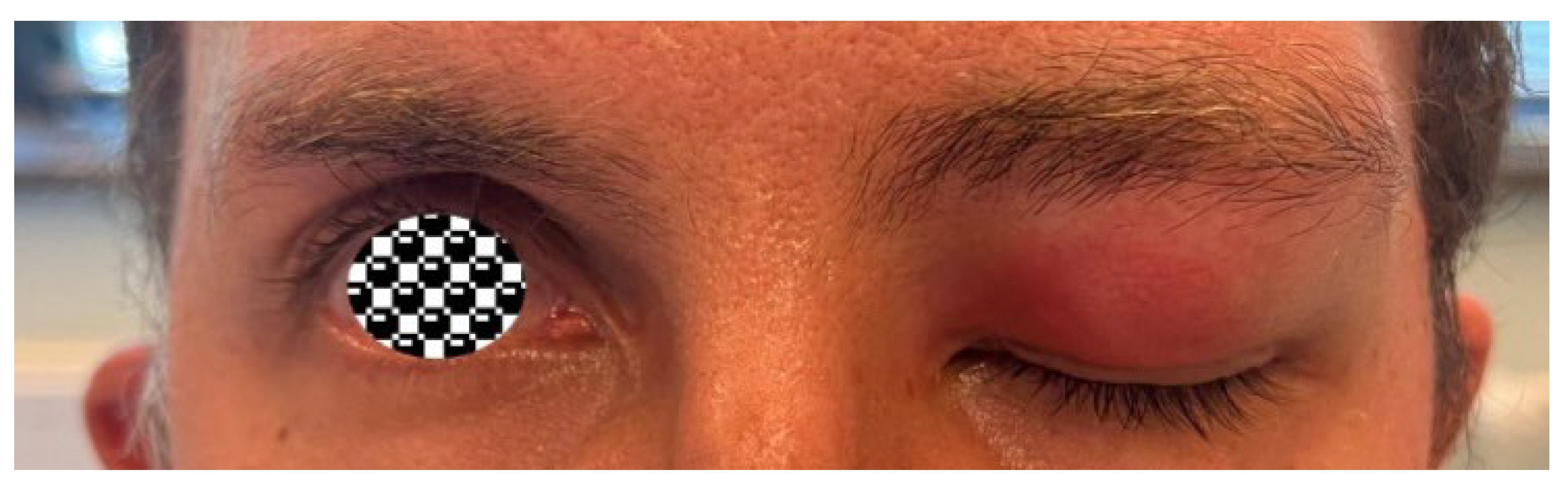 Sinusitis 09 00011 g007 Sinusitis 09 00011 g007