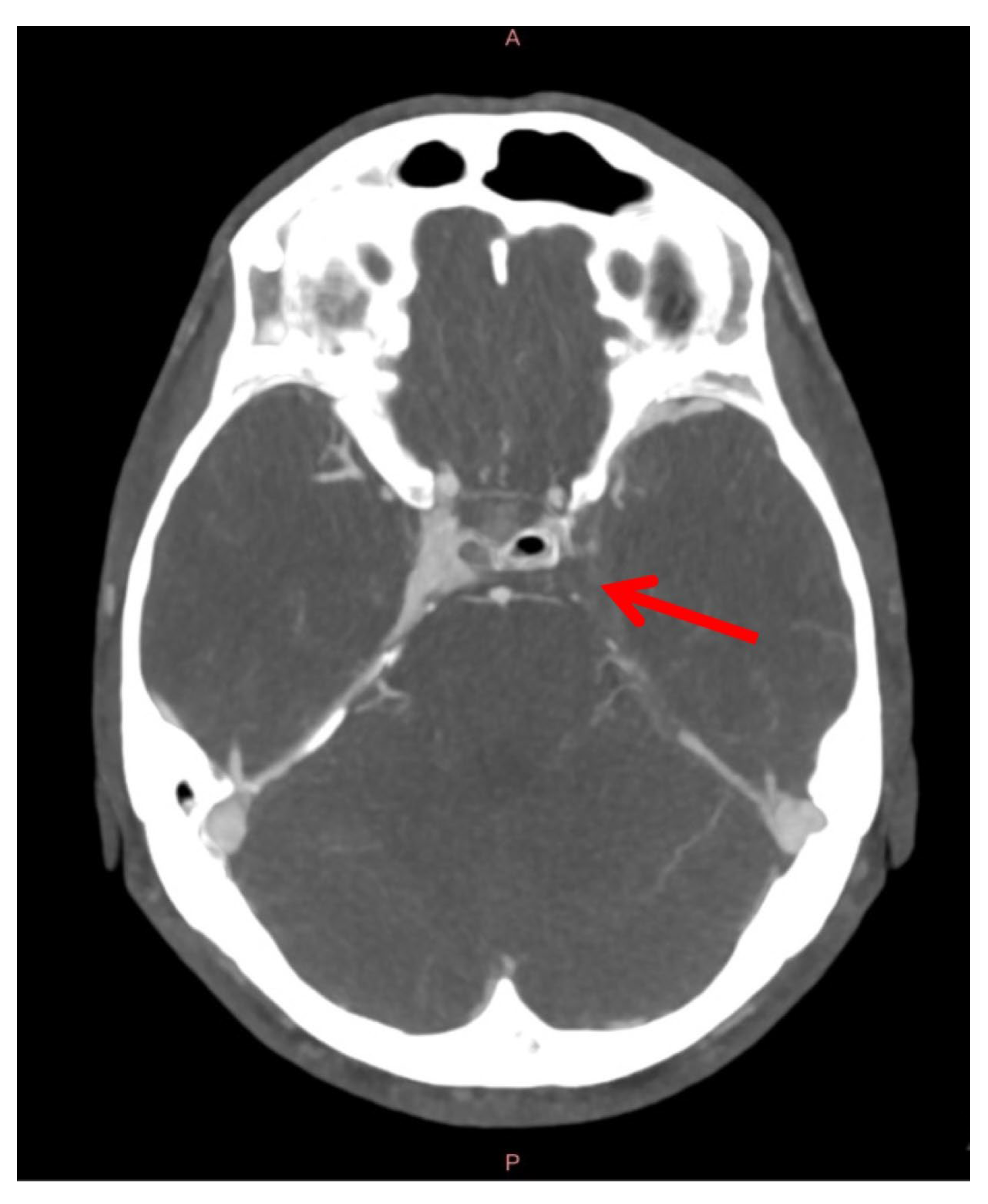 Sinusitis 09 00011 g008 Sinusitis 09 00011 g008