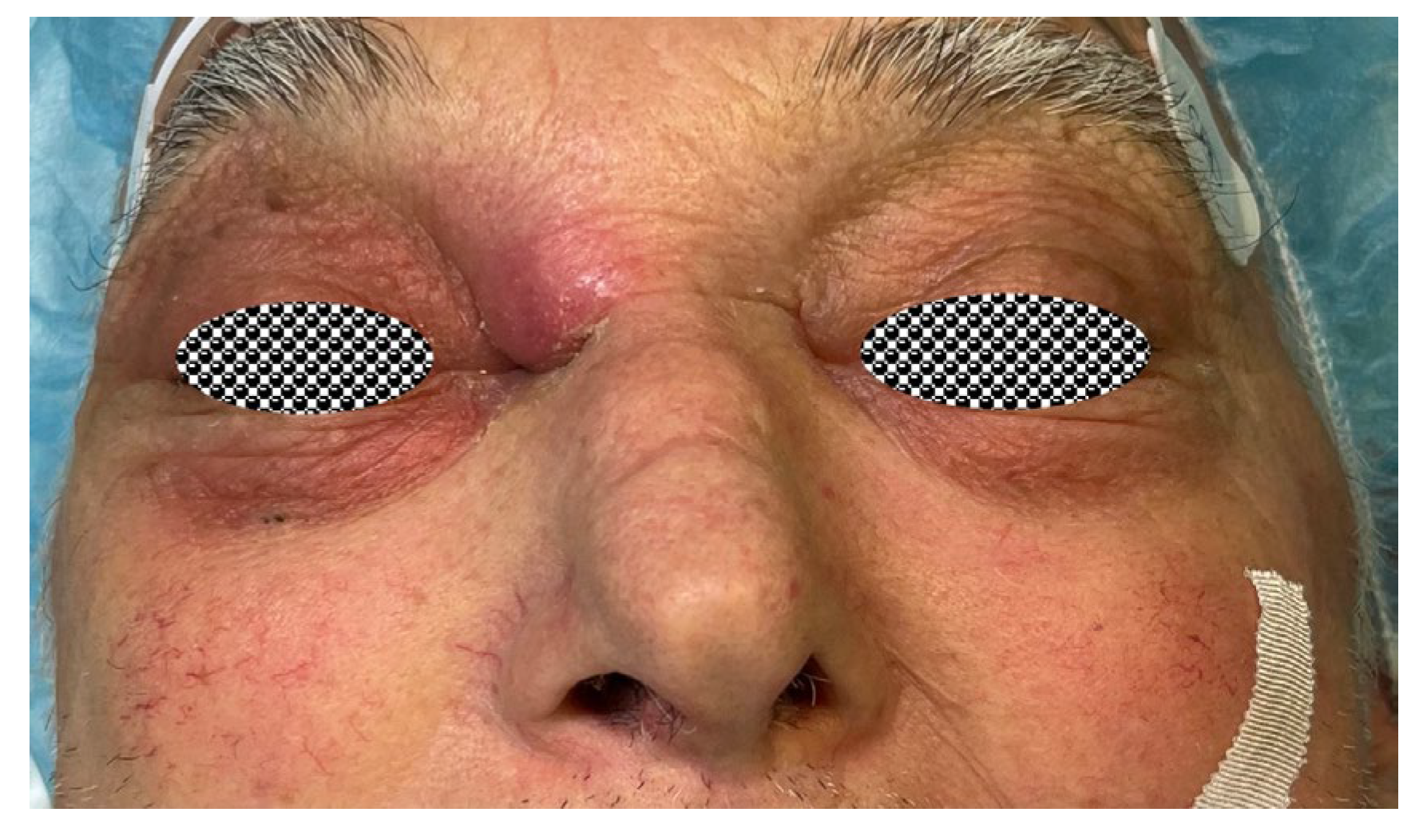 Sinusitis 09 00011 g009 Sinusitis 09 00011 g009