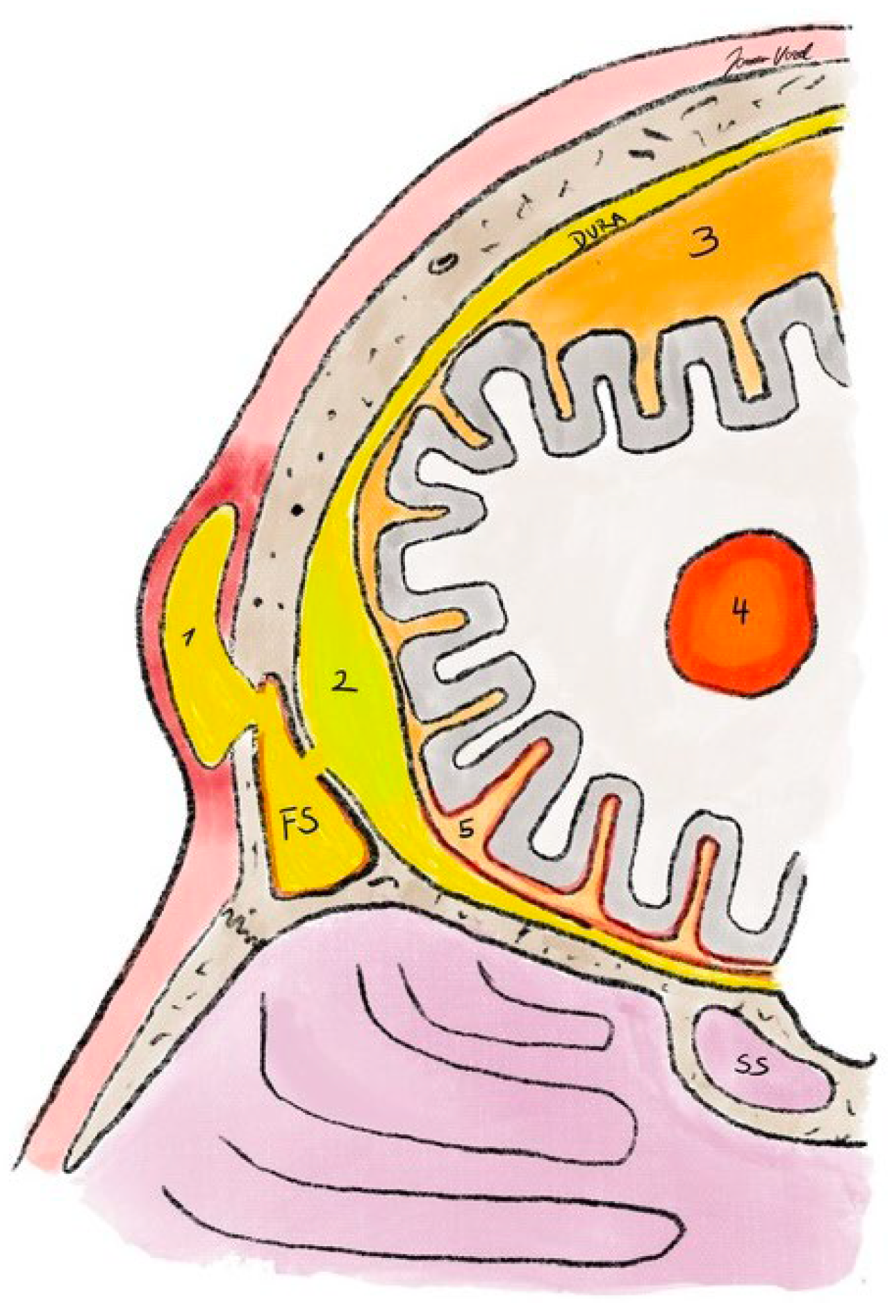 Sinusitis 09 00011 g010 Sinusitis 09 00011 g010