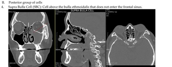 Sinusitis 09 00014 g001c Sinusitis 09 00014 g001c