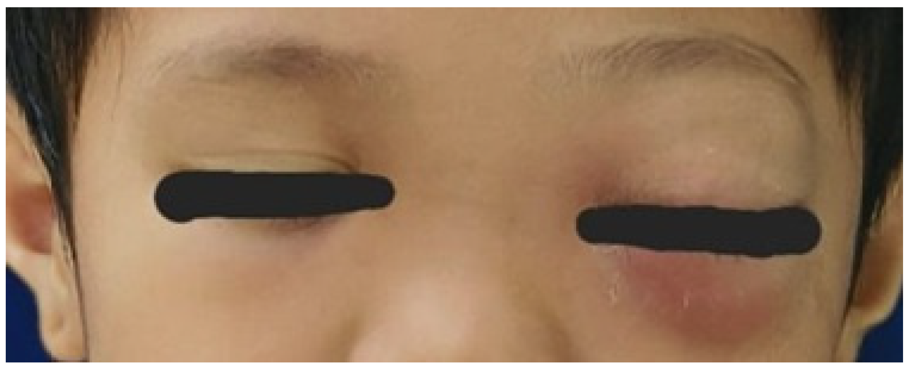 Sinusitis 09 00021 g001