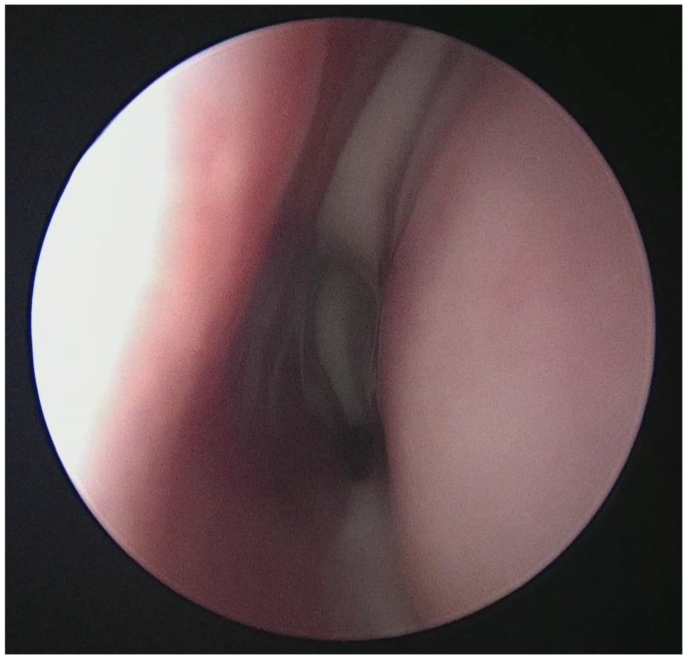 Sinusitis 09 00021 g002