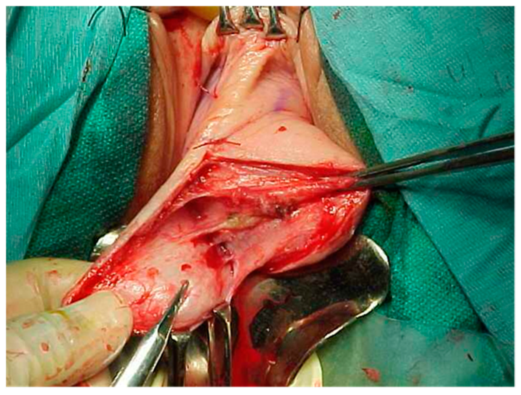 Siuj 06 00012 g003 Siuj 06 00012 g003