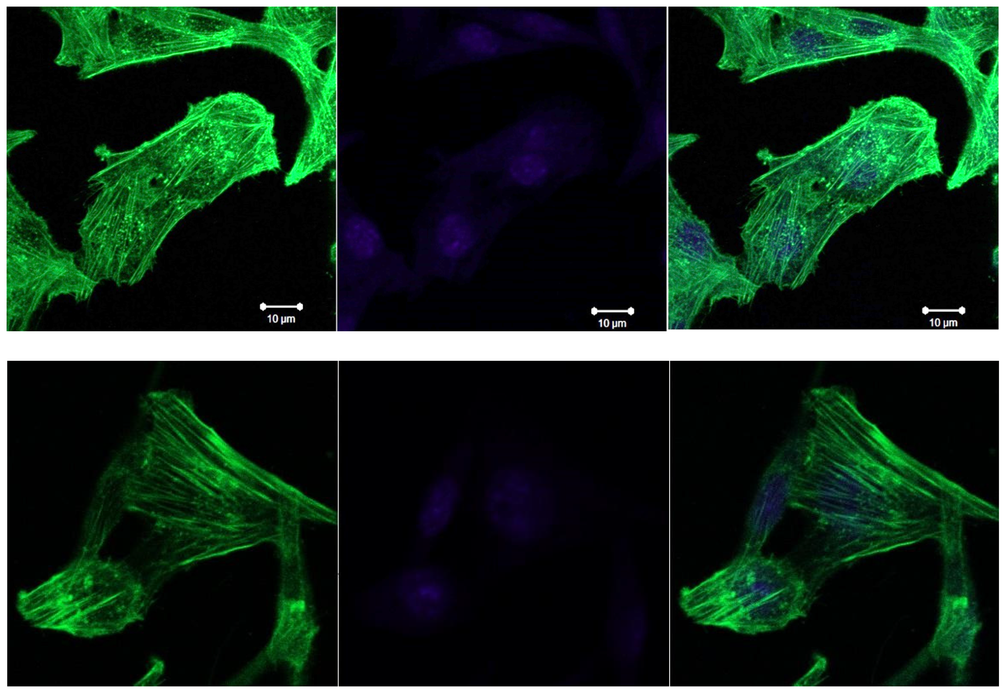 Spectroscj 02 00018 g010