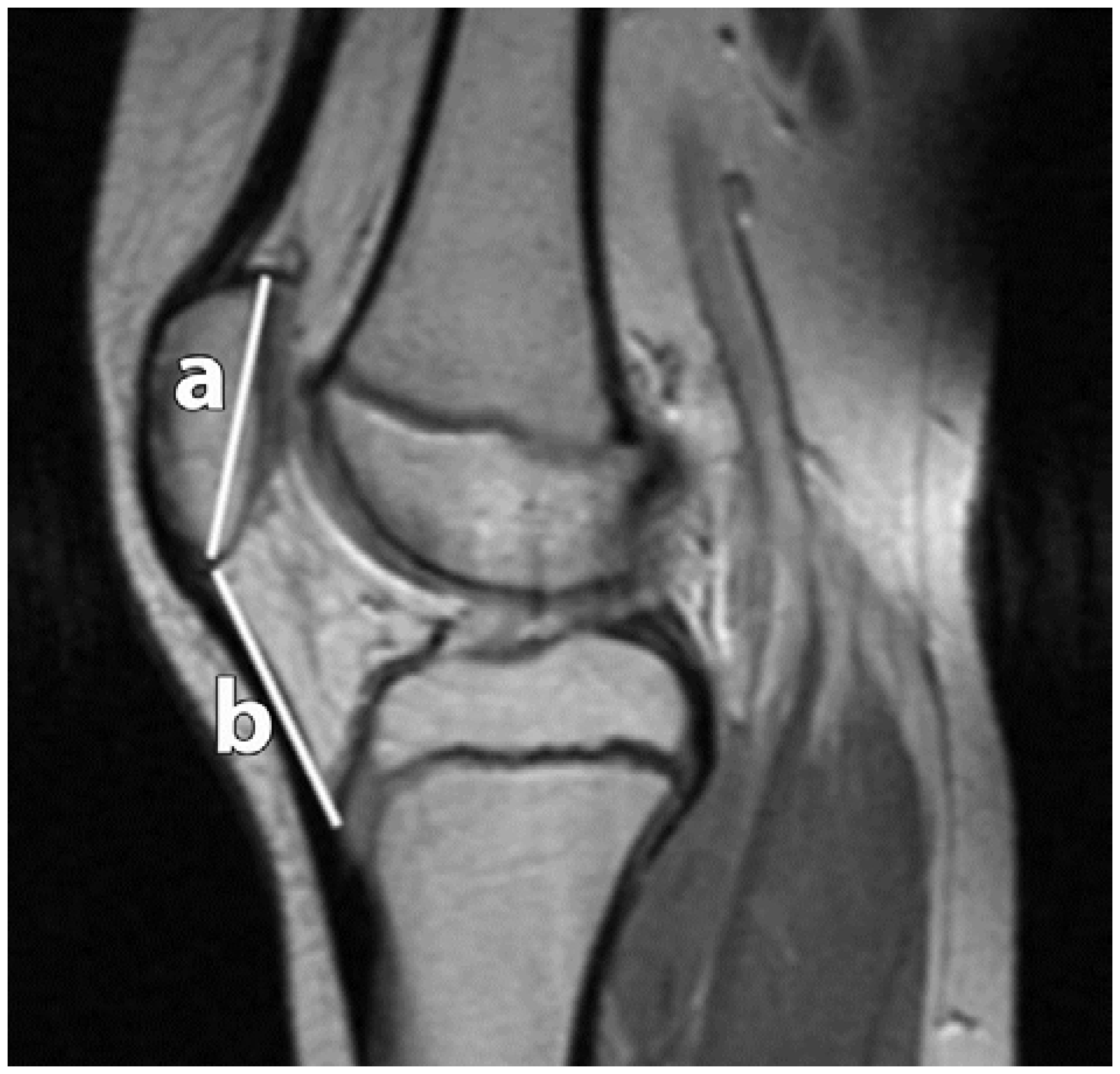 Sports 04 00024 g006