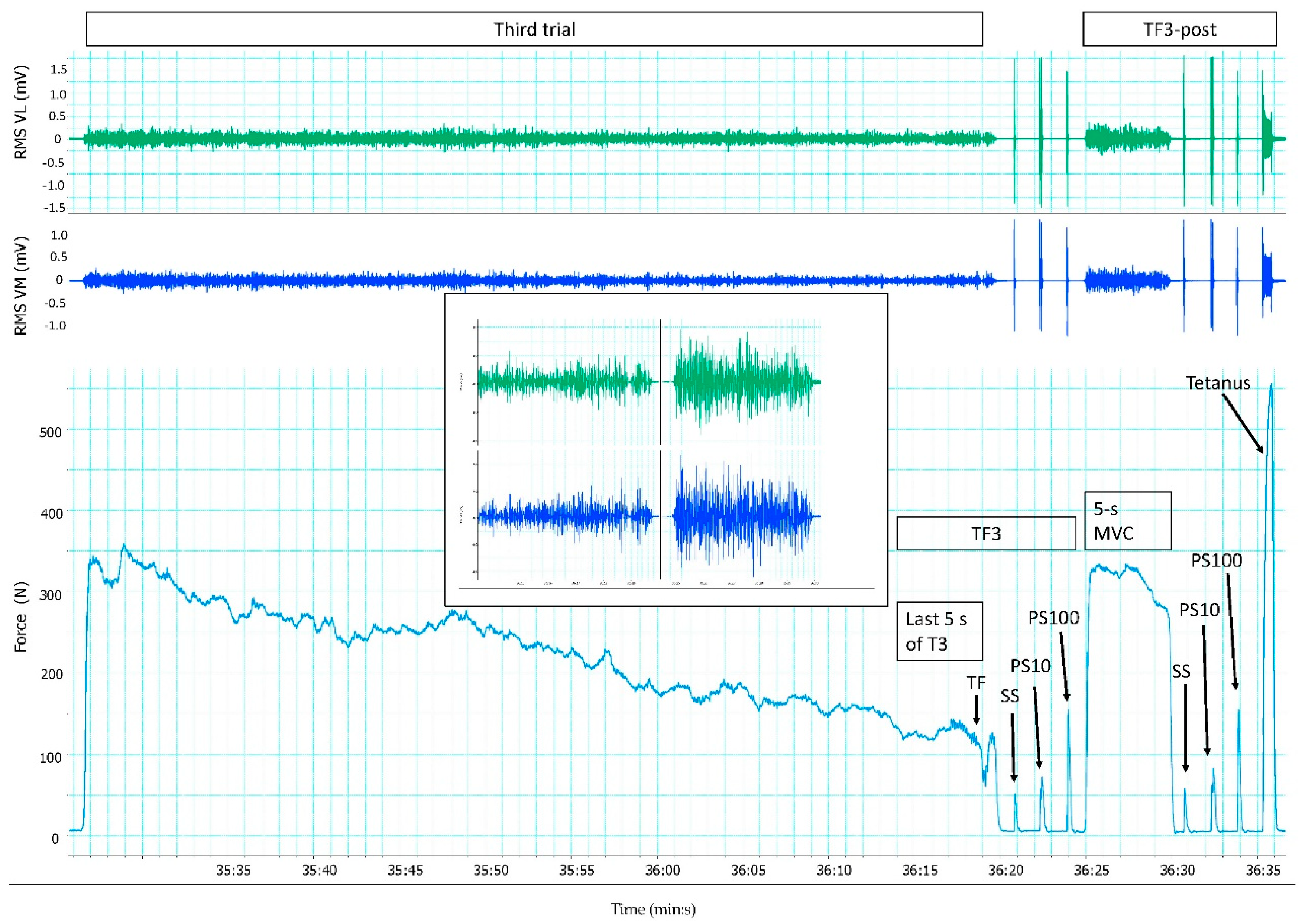 Sports 06 00156 g003