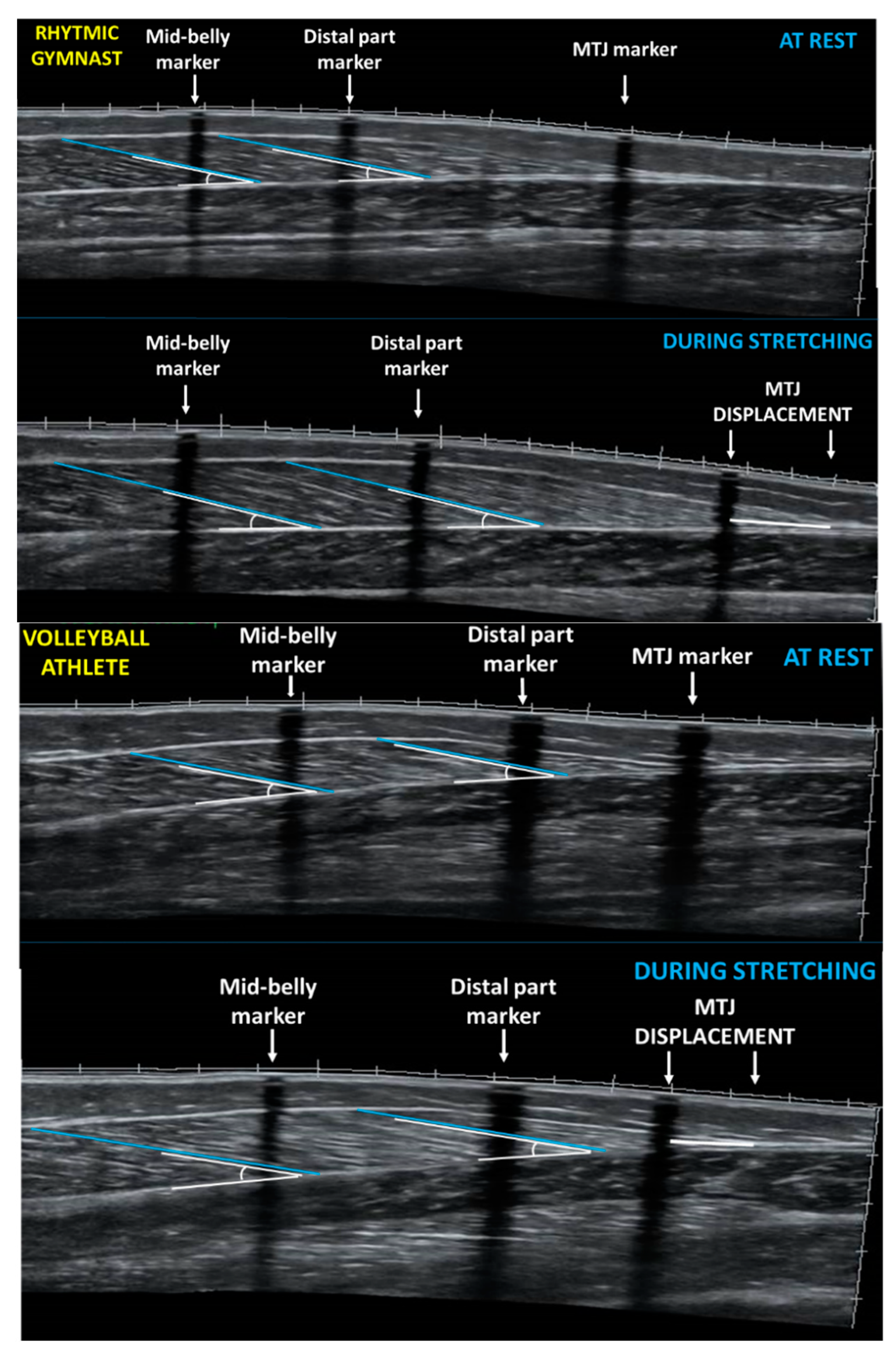 Sports 08 00029 g001