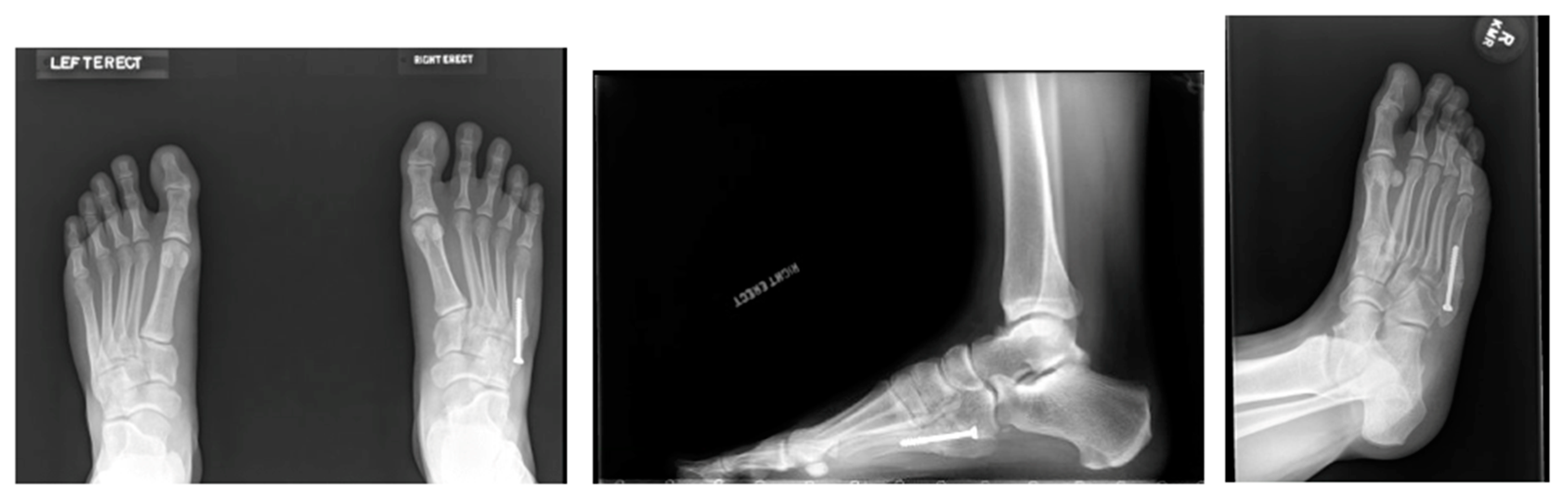 Sports 12 00007 g004