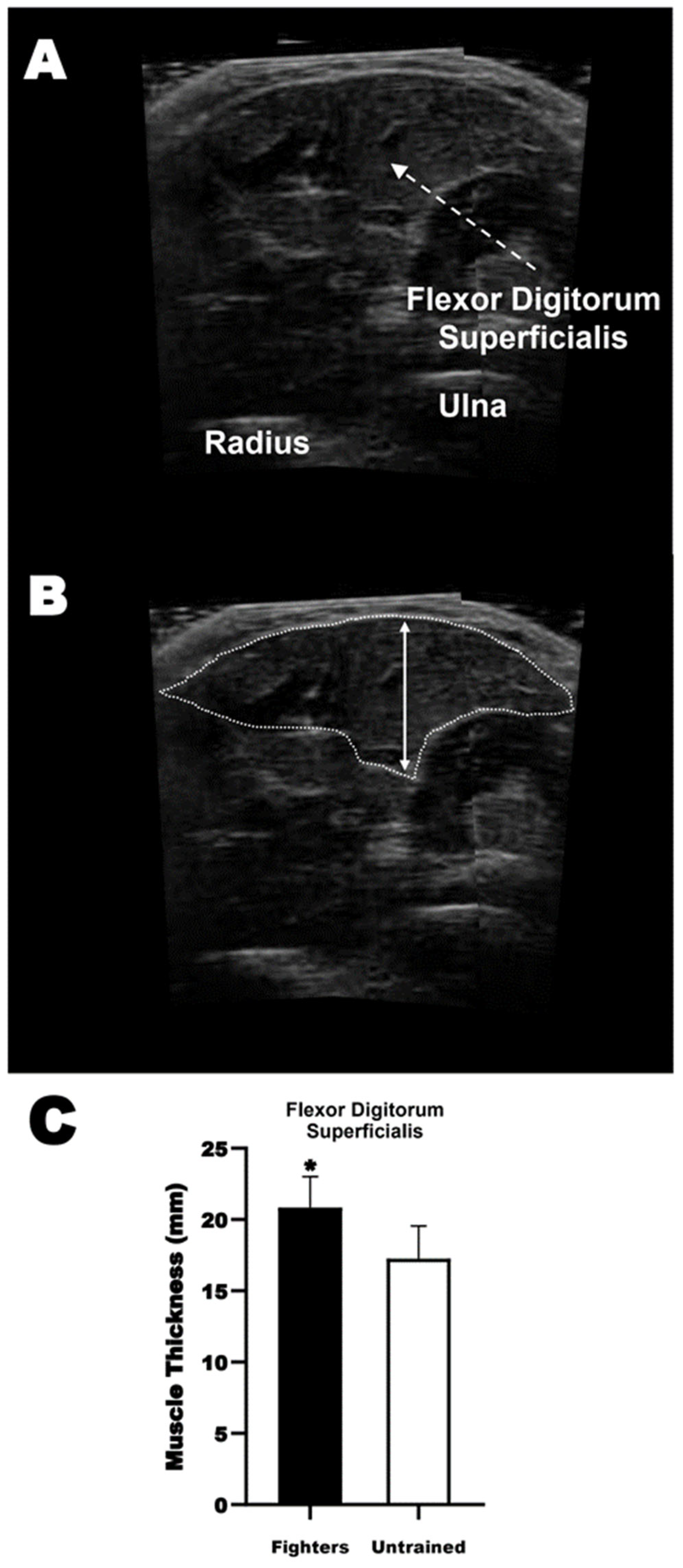 Sports 12 00066 g003
