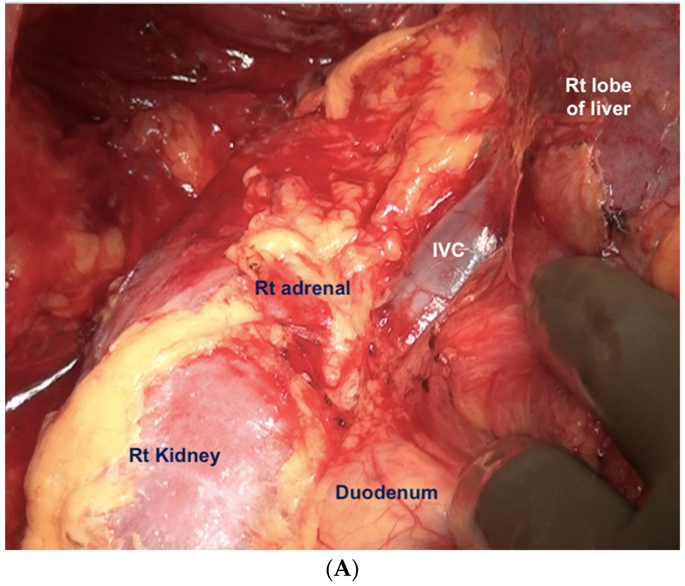 Std 12 00001 g012a Std 12 00001 g012a