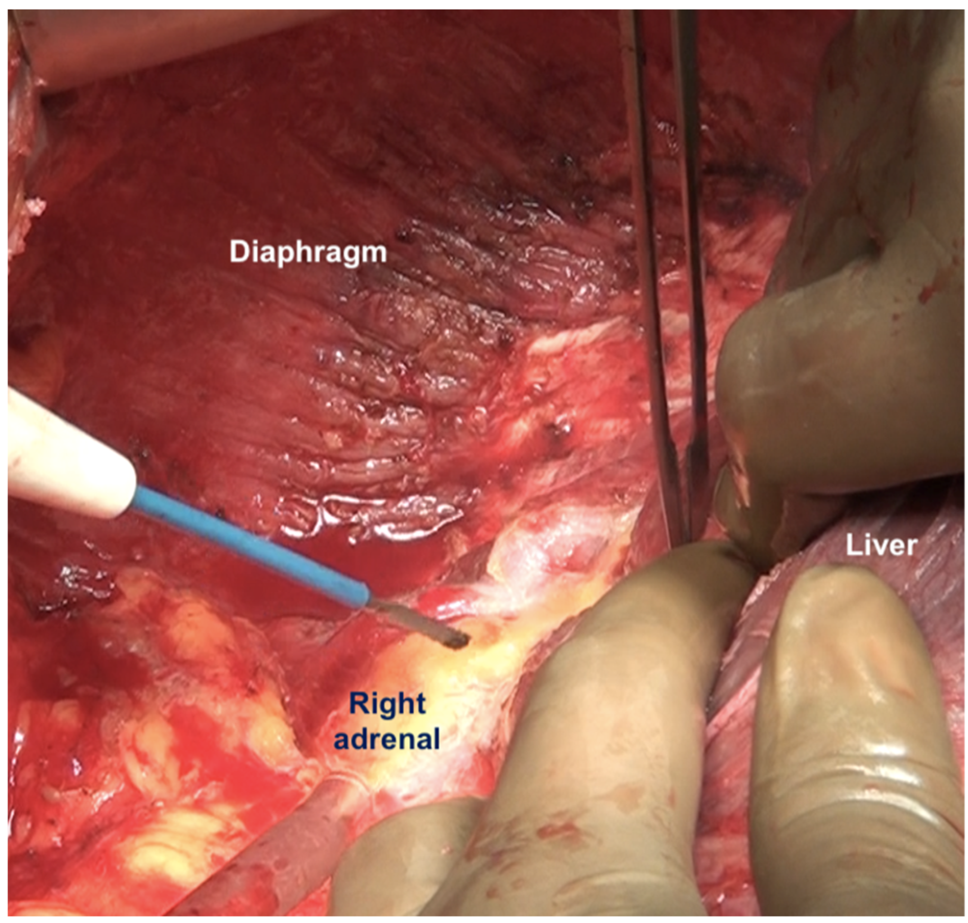 Std 12 00001 g013 Std 12 00001 g013