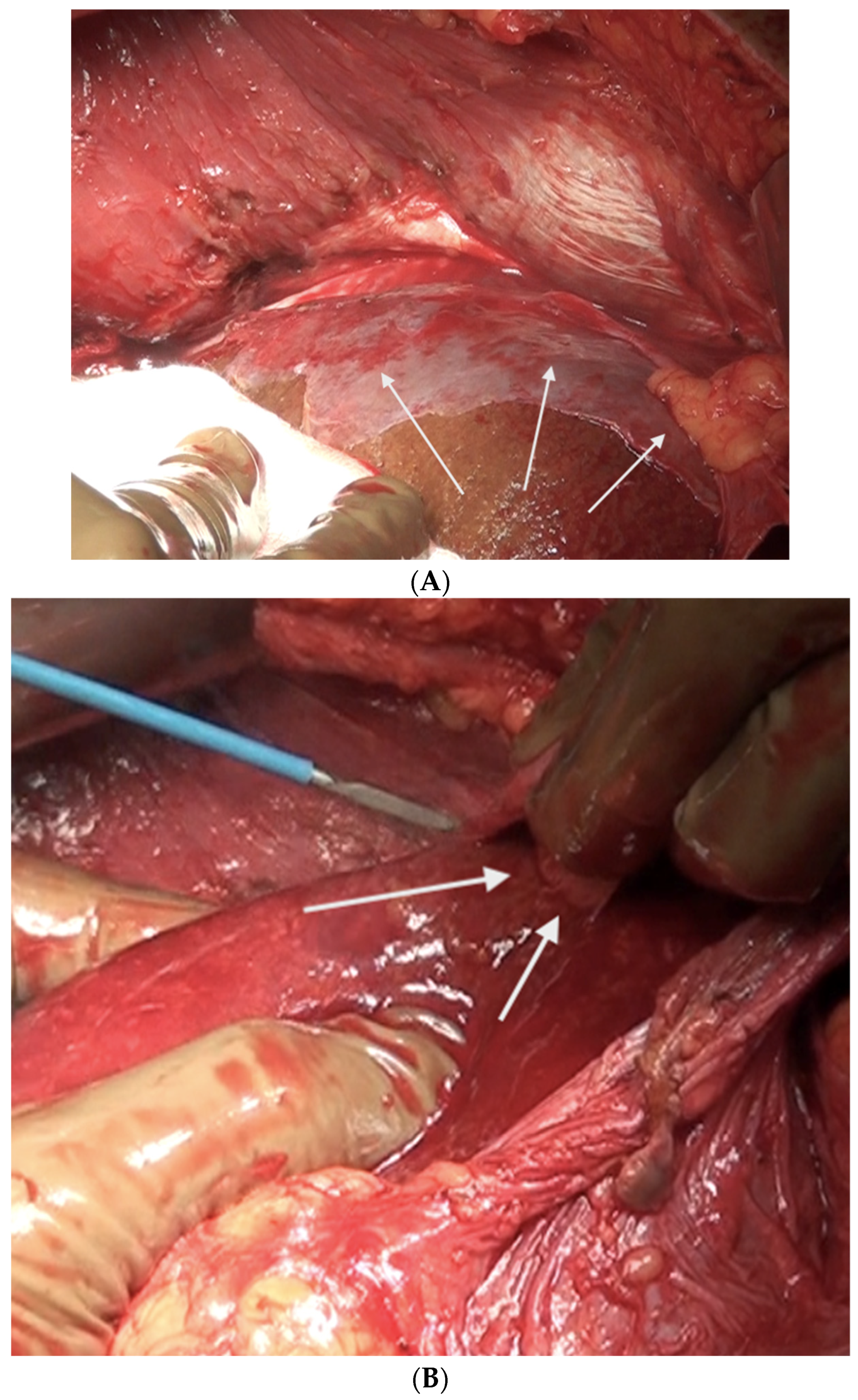 Std 12 00001 g015 Std 12 00001 g015