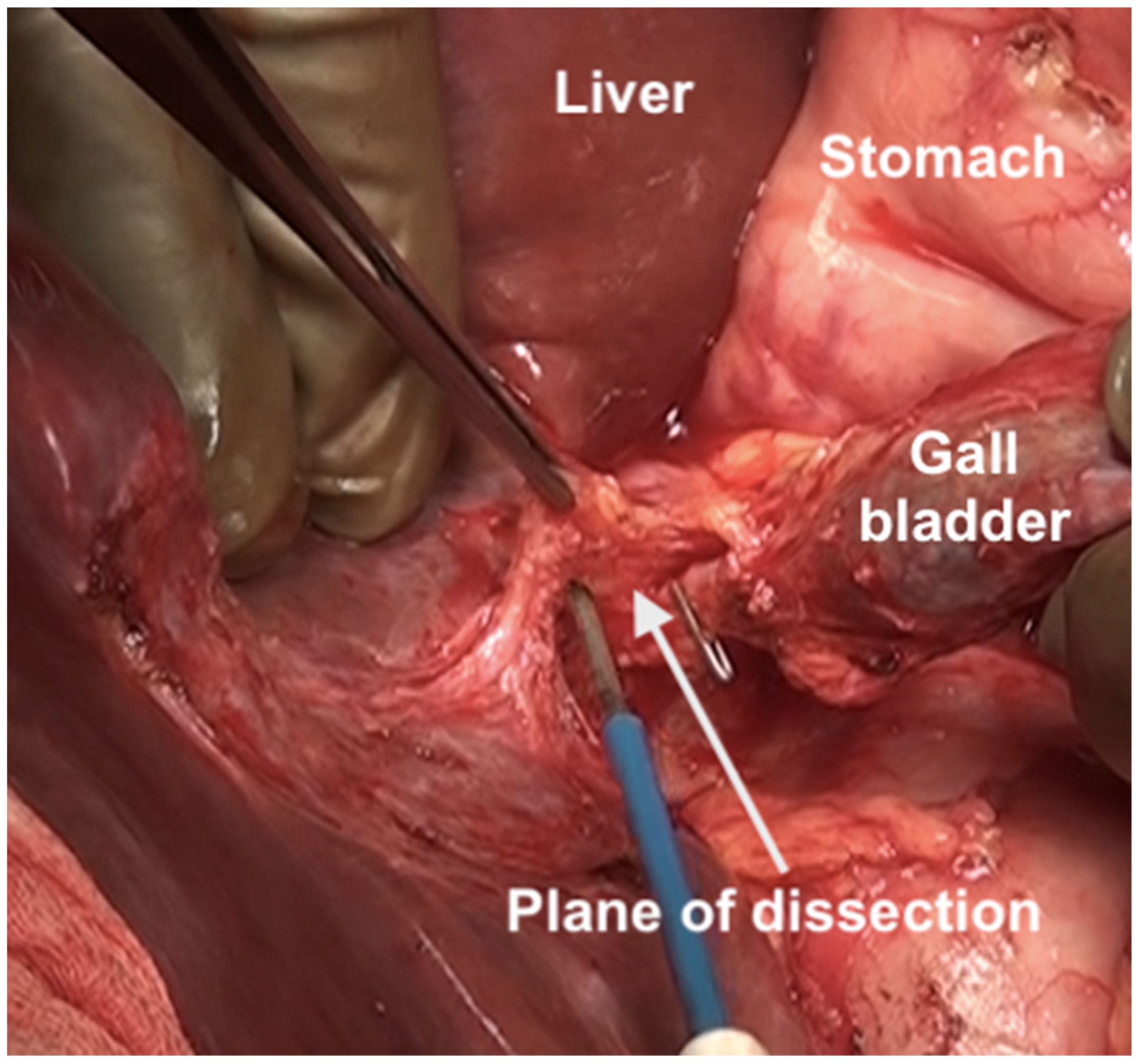 Std 12 00001 g021 Std 12 00001 g021