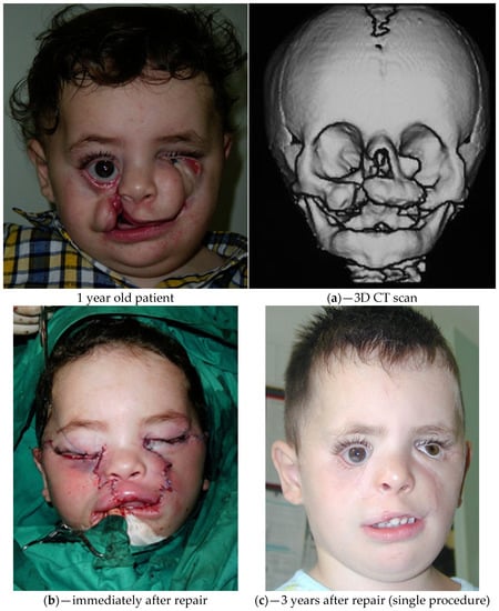 Std 12 00002 g004a Std 12 00002 g004a