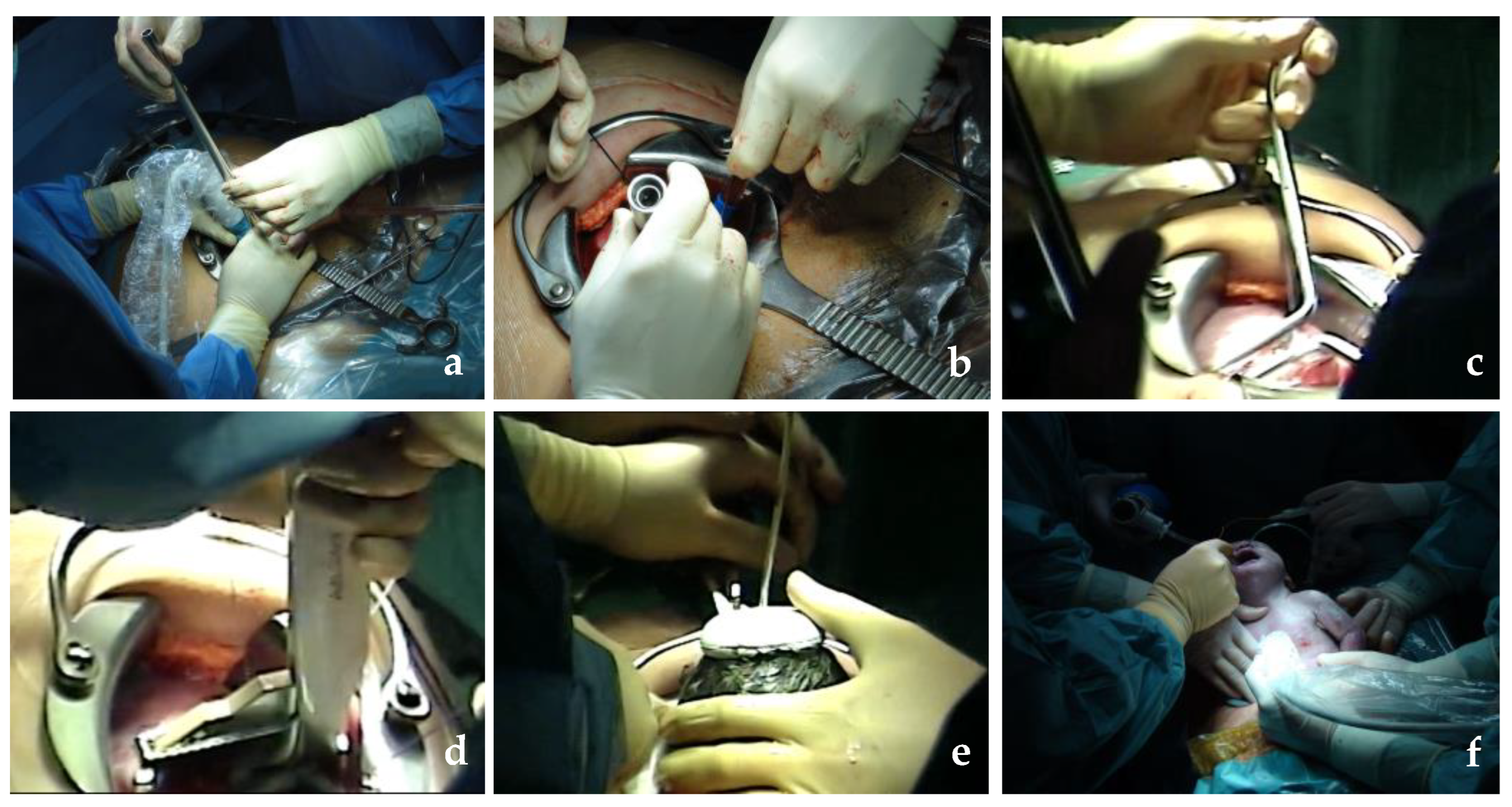 Std 13 00005 g005 Std 13 00005 g005