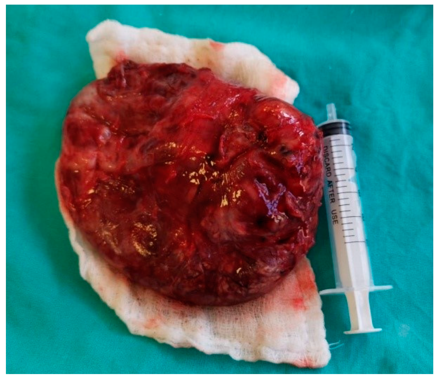 Surgeries 01 00006 g004 Surgeries 01 00006 g004