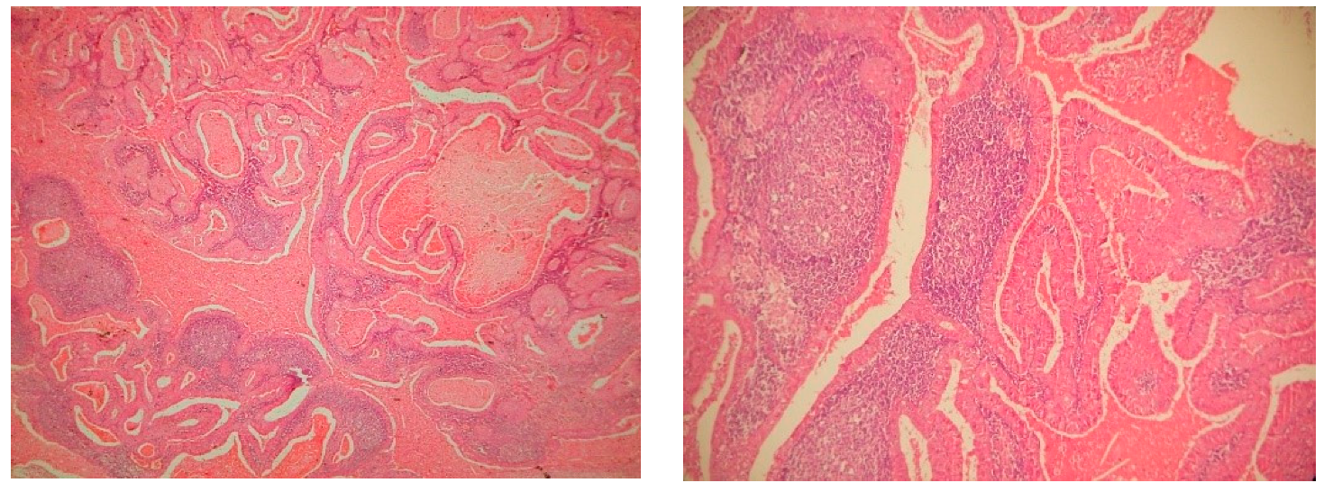 Surgeries 01 00006 g005 Surgeries 01 00006 g005