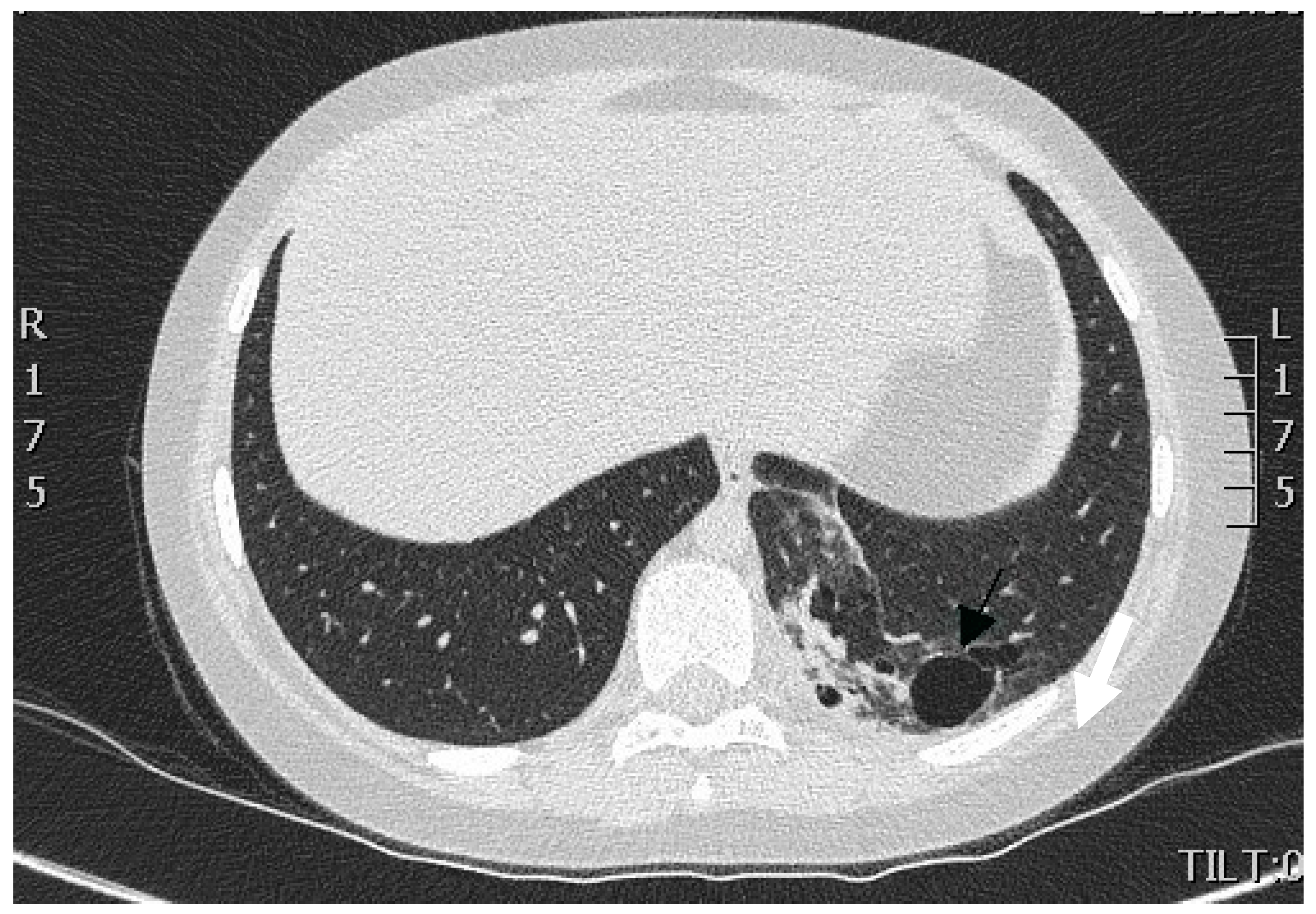 Surgeries 02 00009 g001