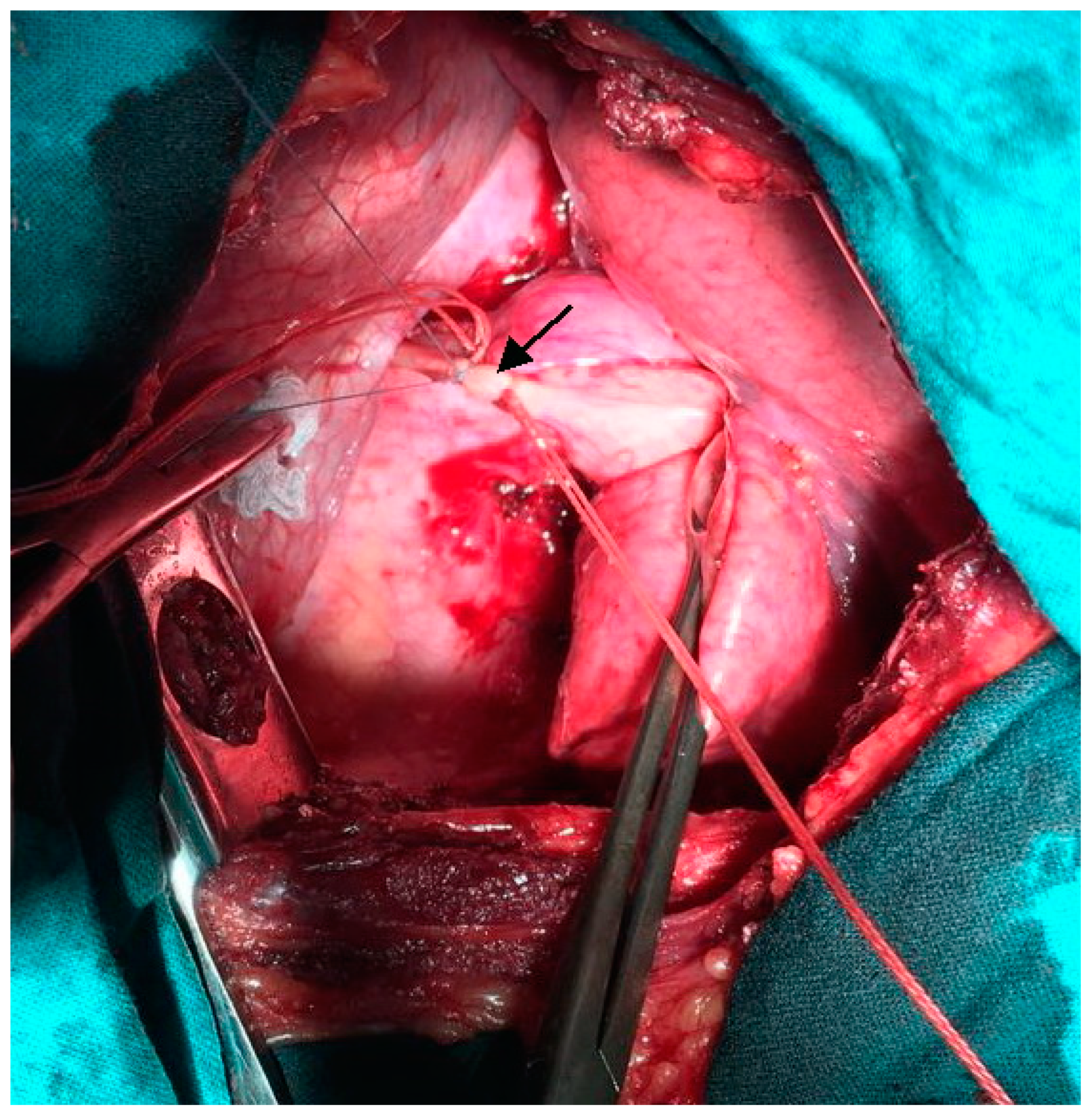 Surgeries 02 00009 g003