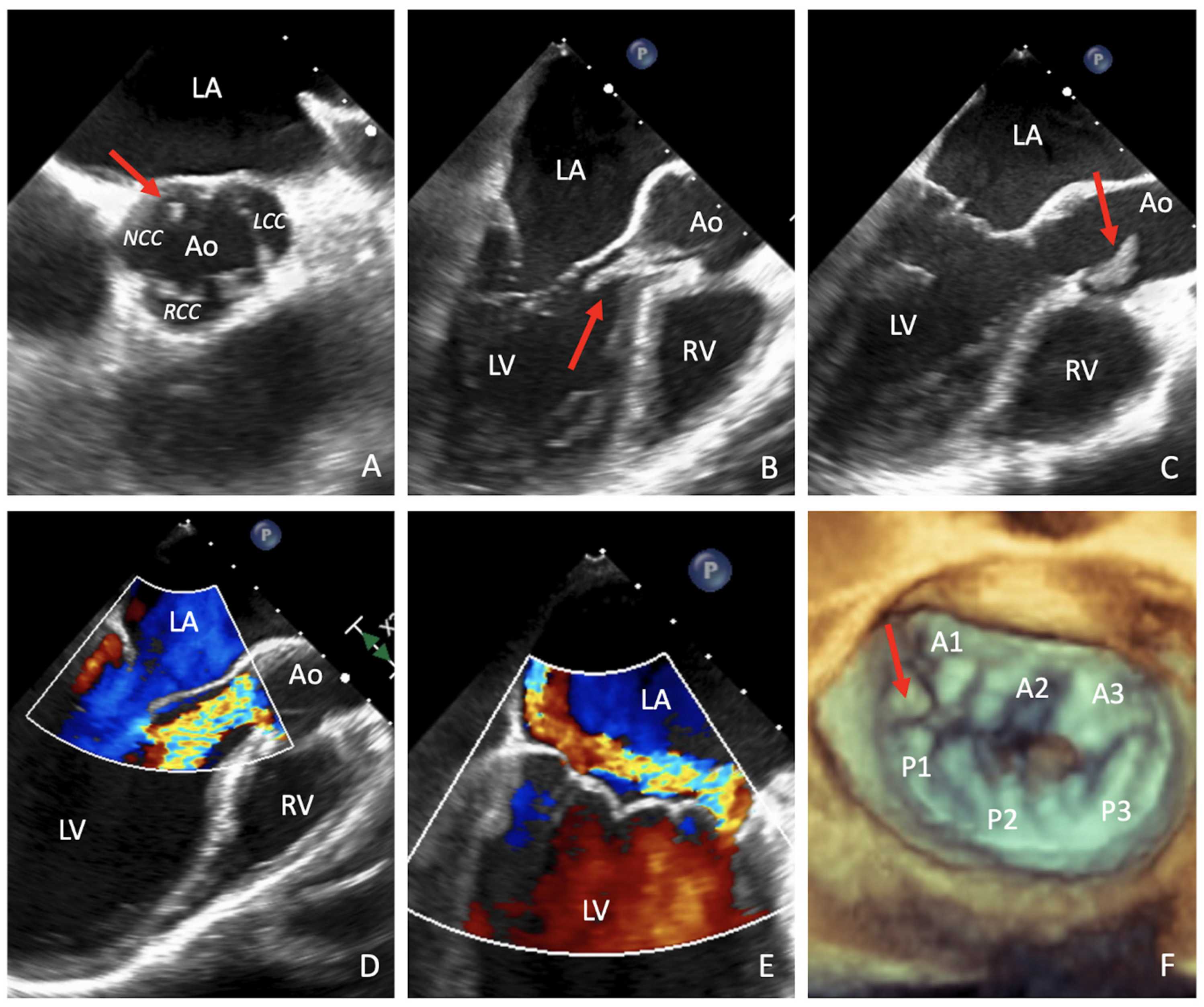 Surgeries 02 00010 g001