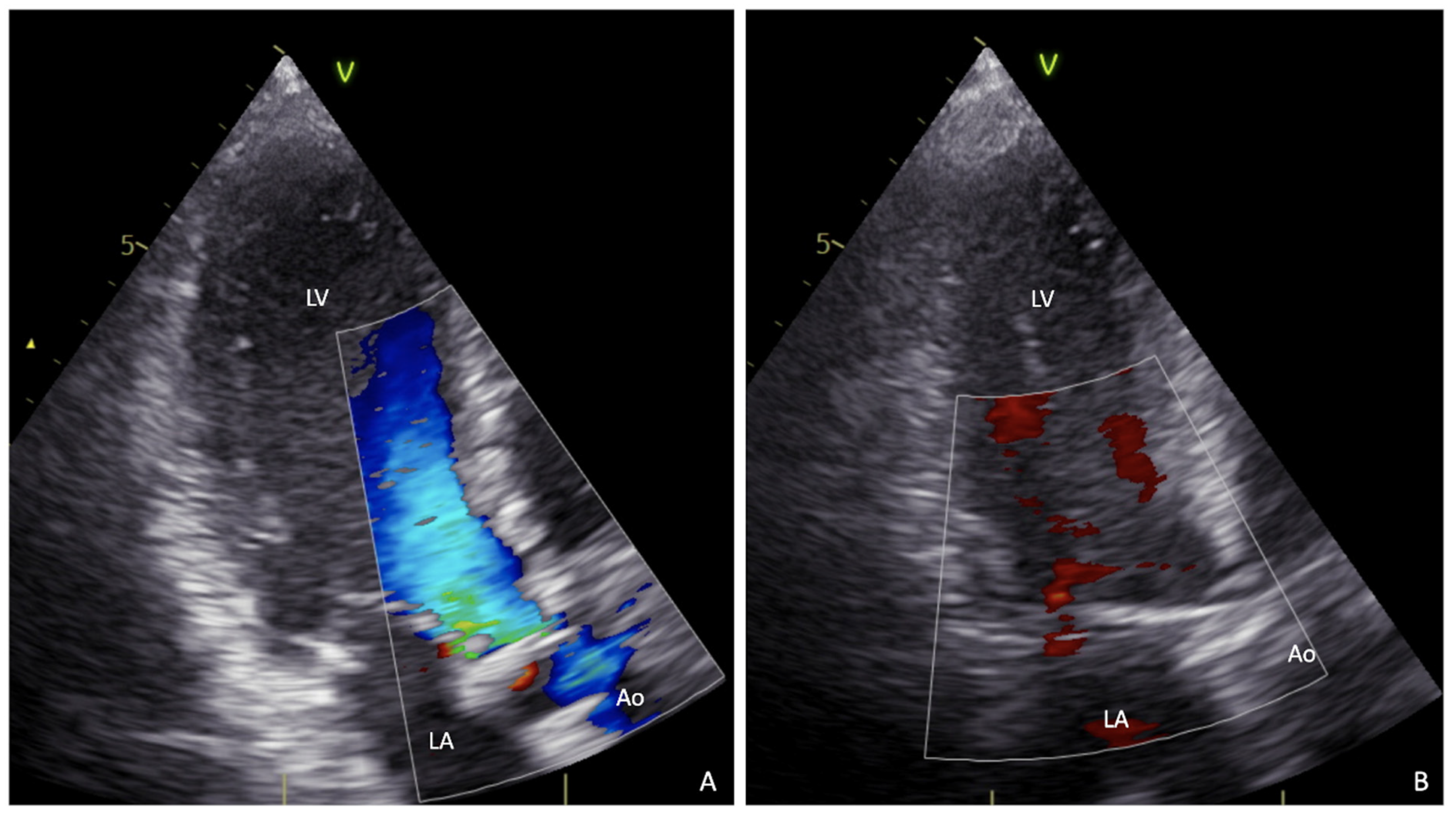 Surgeries 02 00010 g003