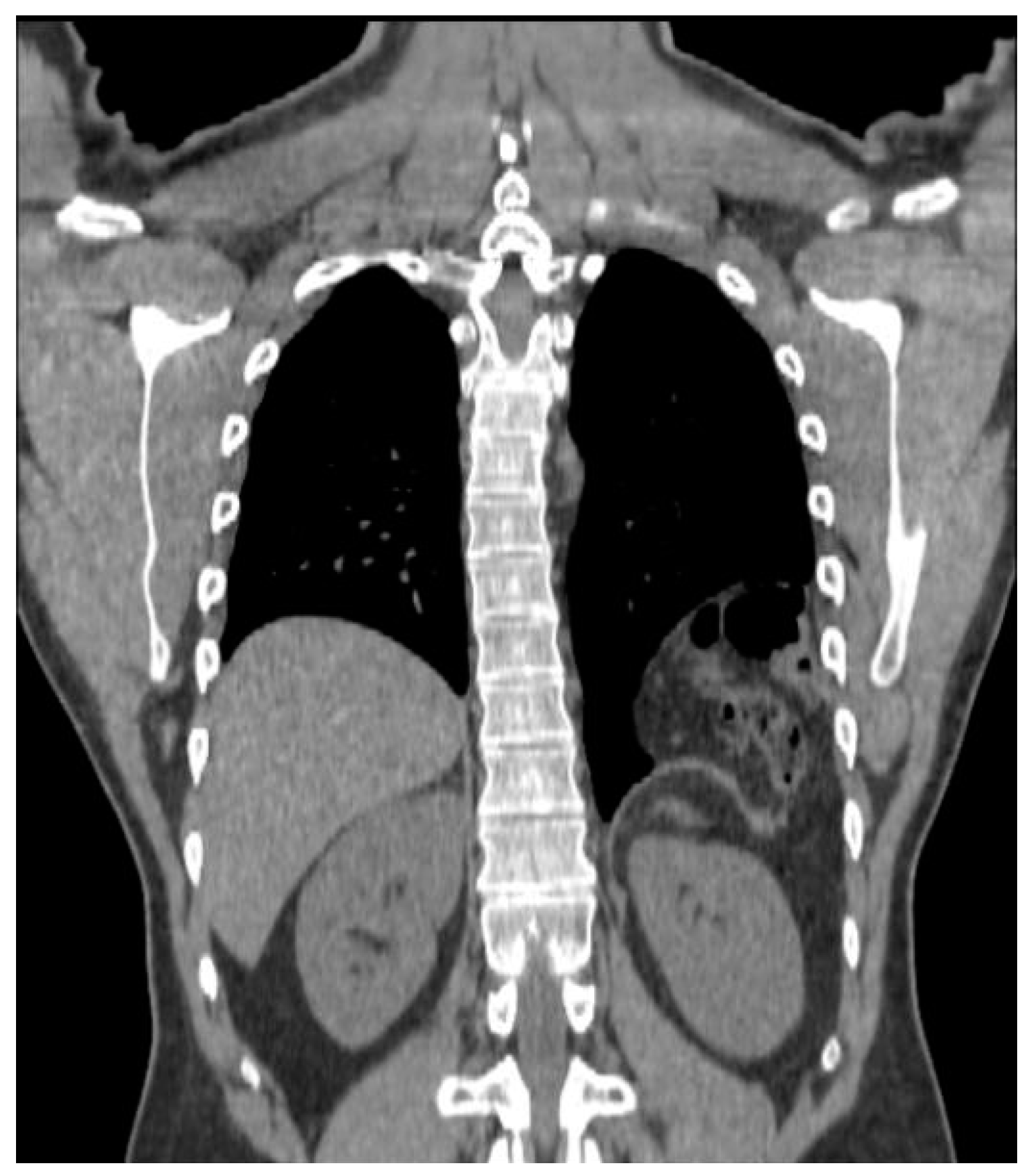Surgeries 02 00014 g001