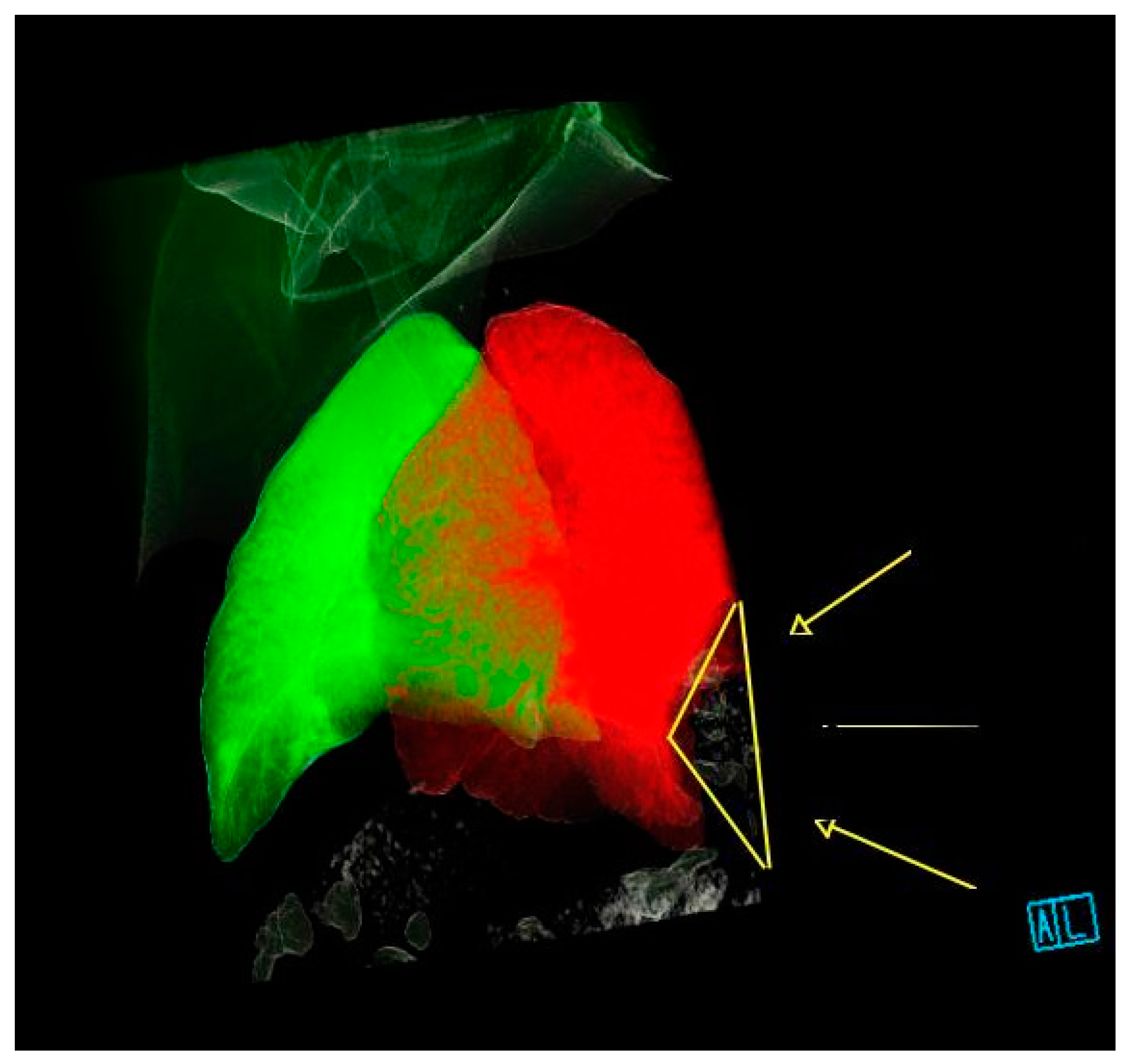 Surgeries 02 00014 g002