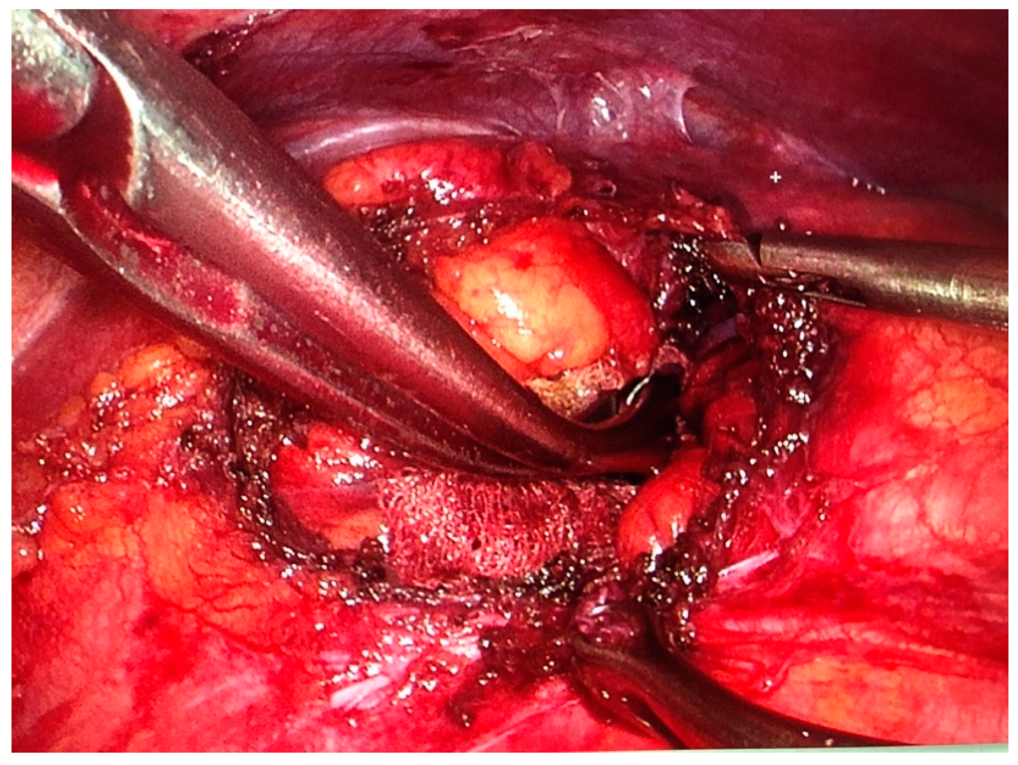 Surgeries 02 00014 g003