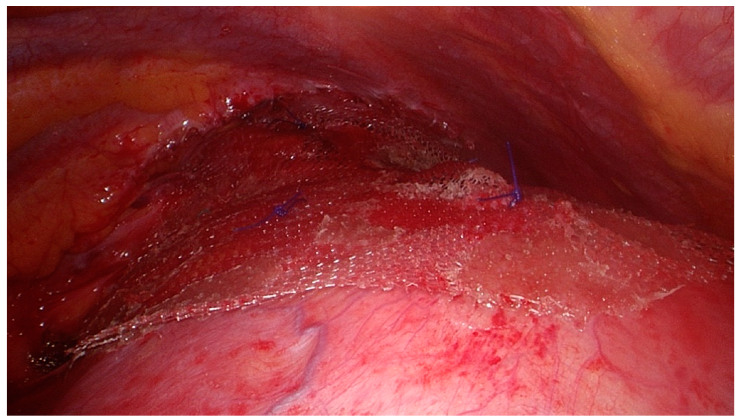 Surgeries 02 00014 g005